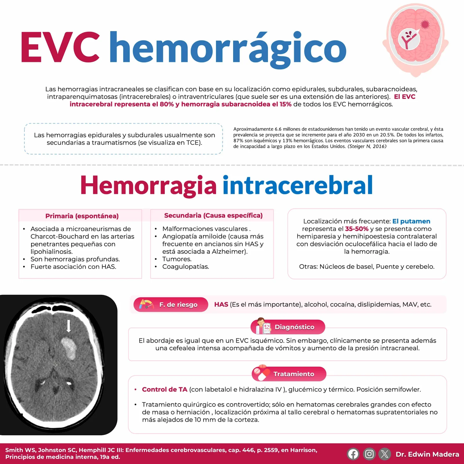 EVC hemorrágico