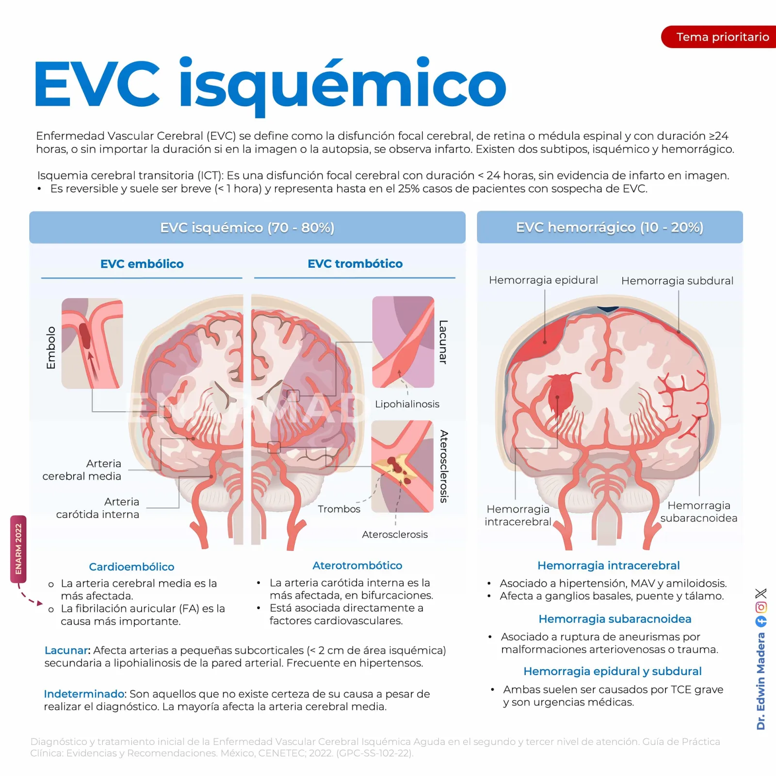 EVC isquémico