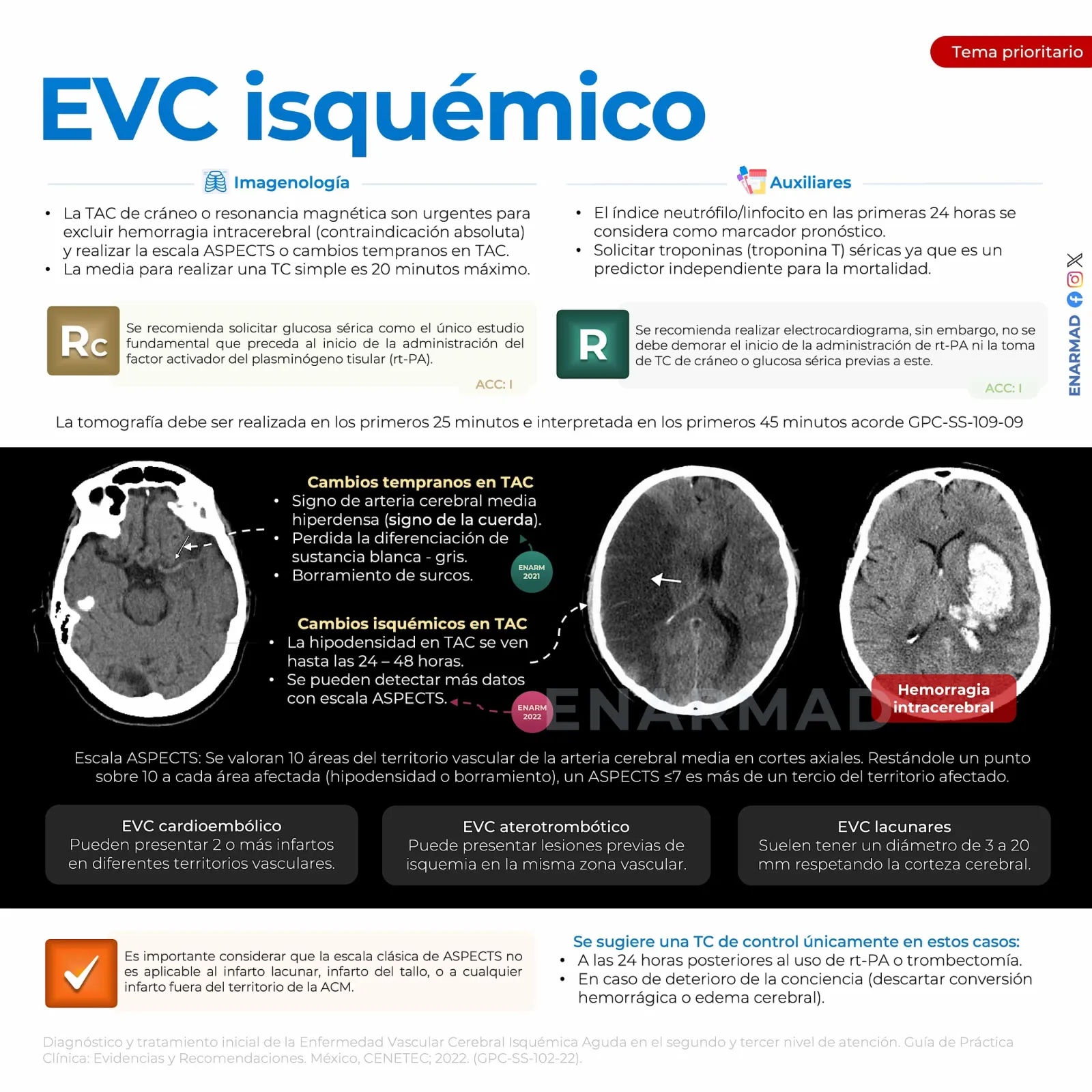 EVC isquémico