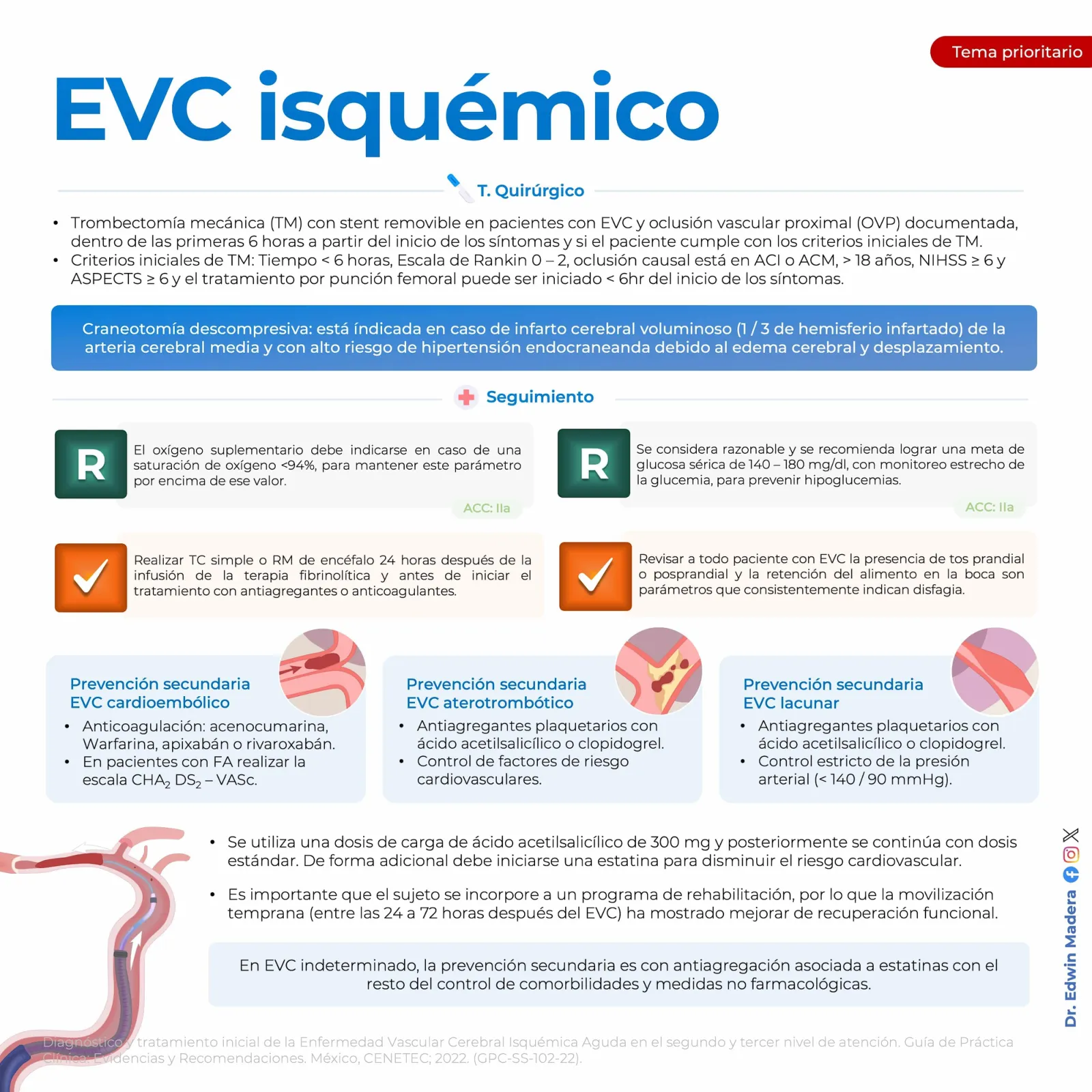 EVC isquémico