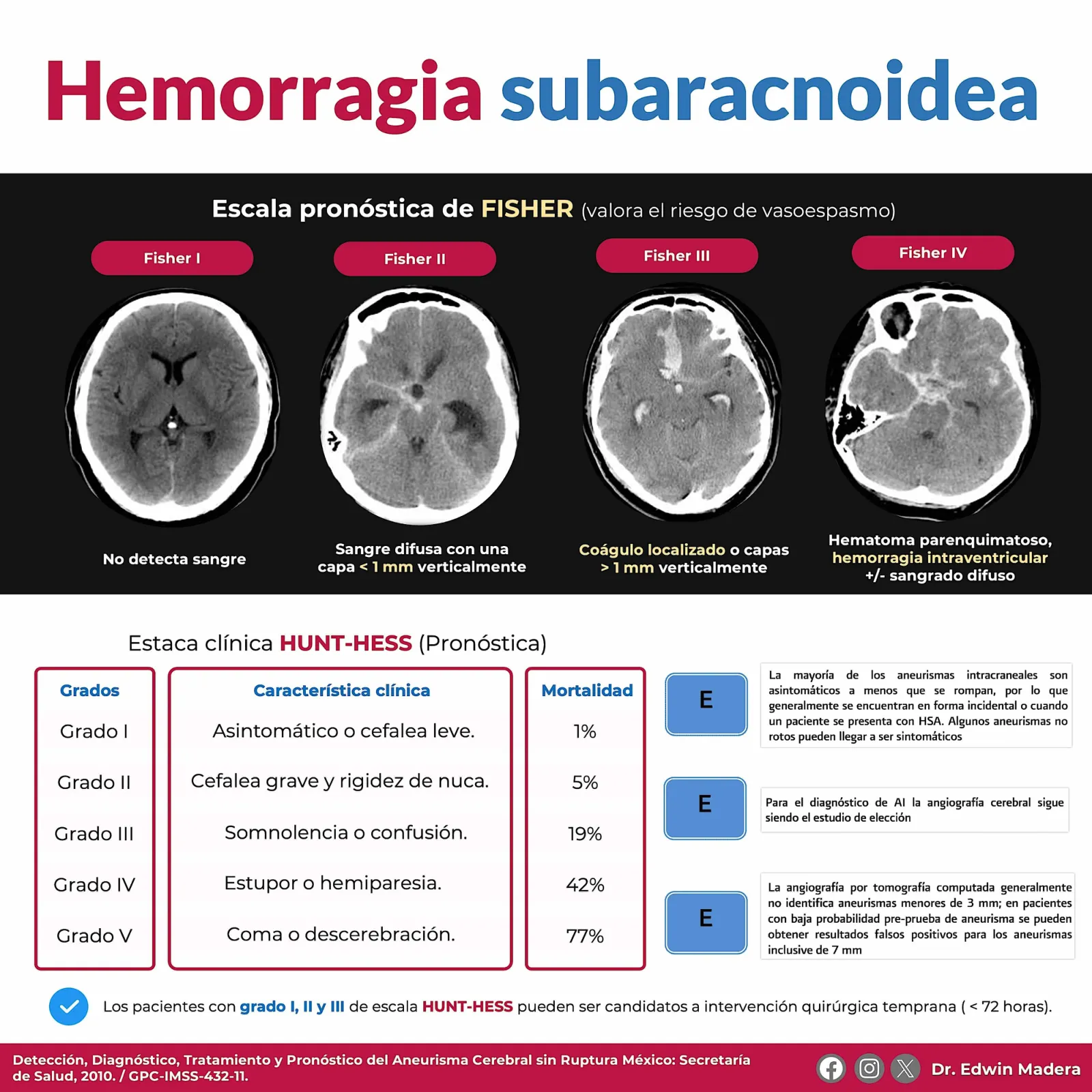 Hemorragia subaracnoidea
