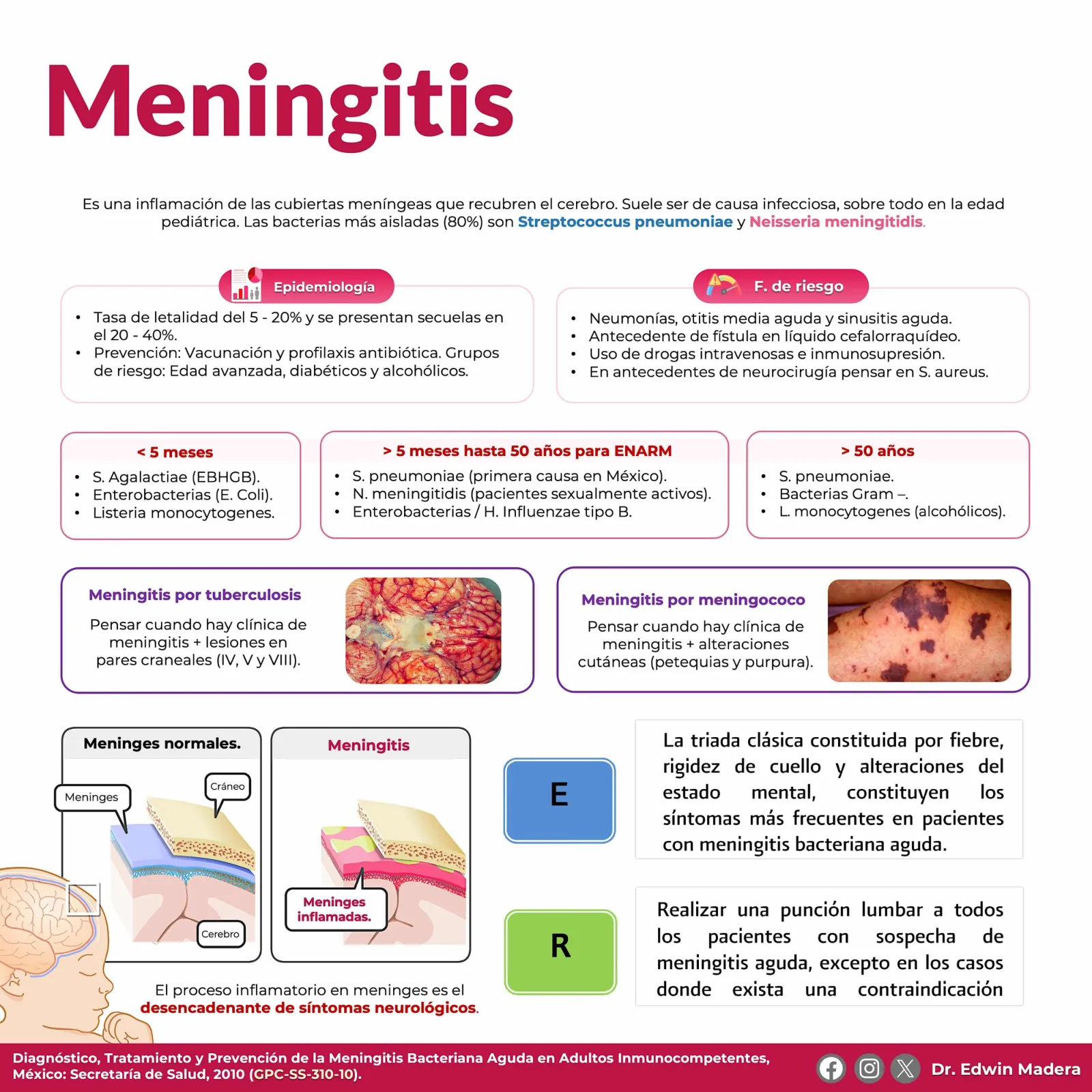Meningitis