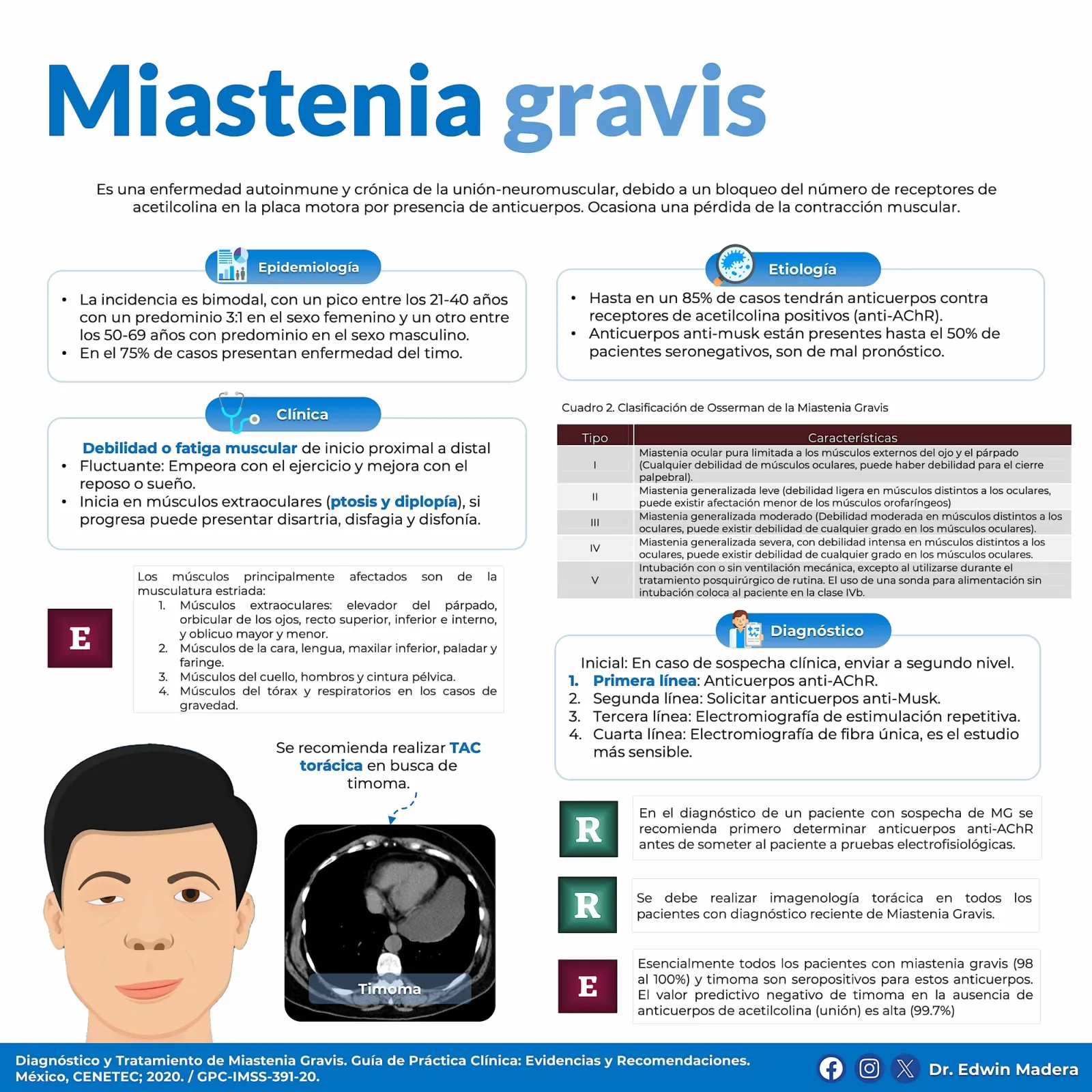 Miastenia gravis