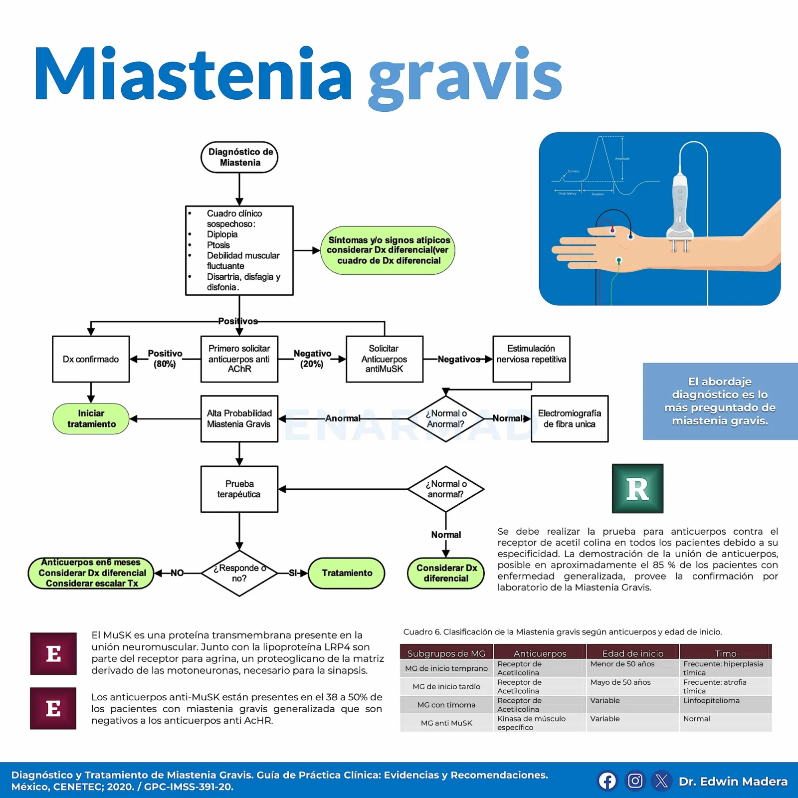 Miastenia gravis
