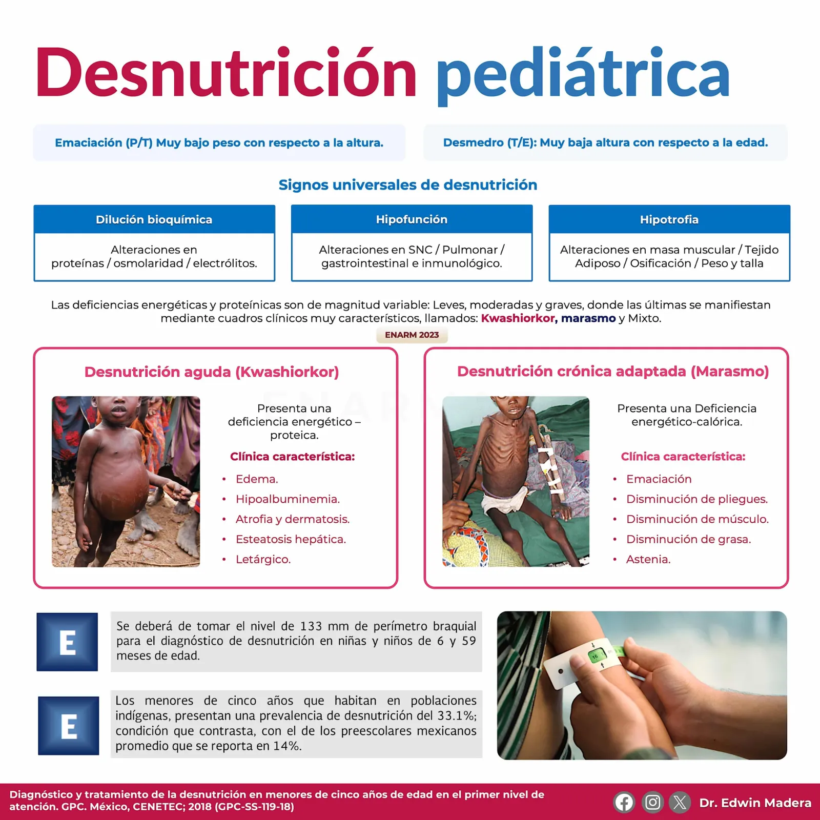 Desnutrición pedíatrica