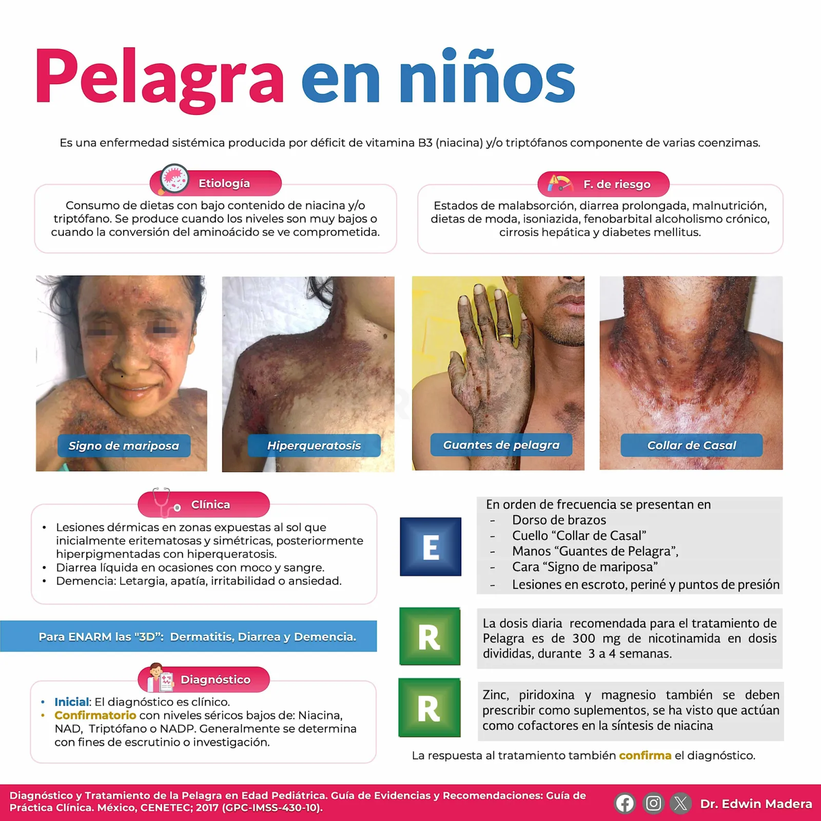 Pelagra en niños