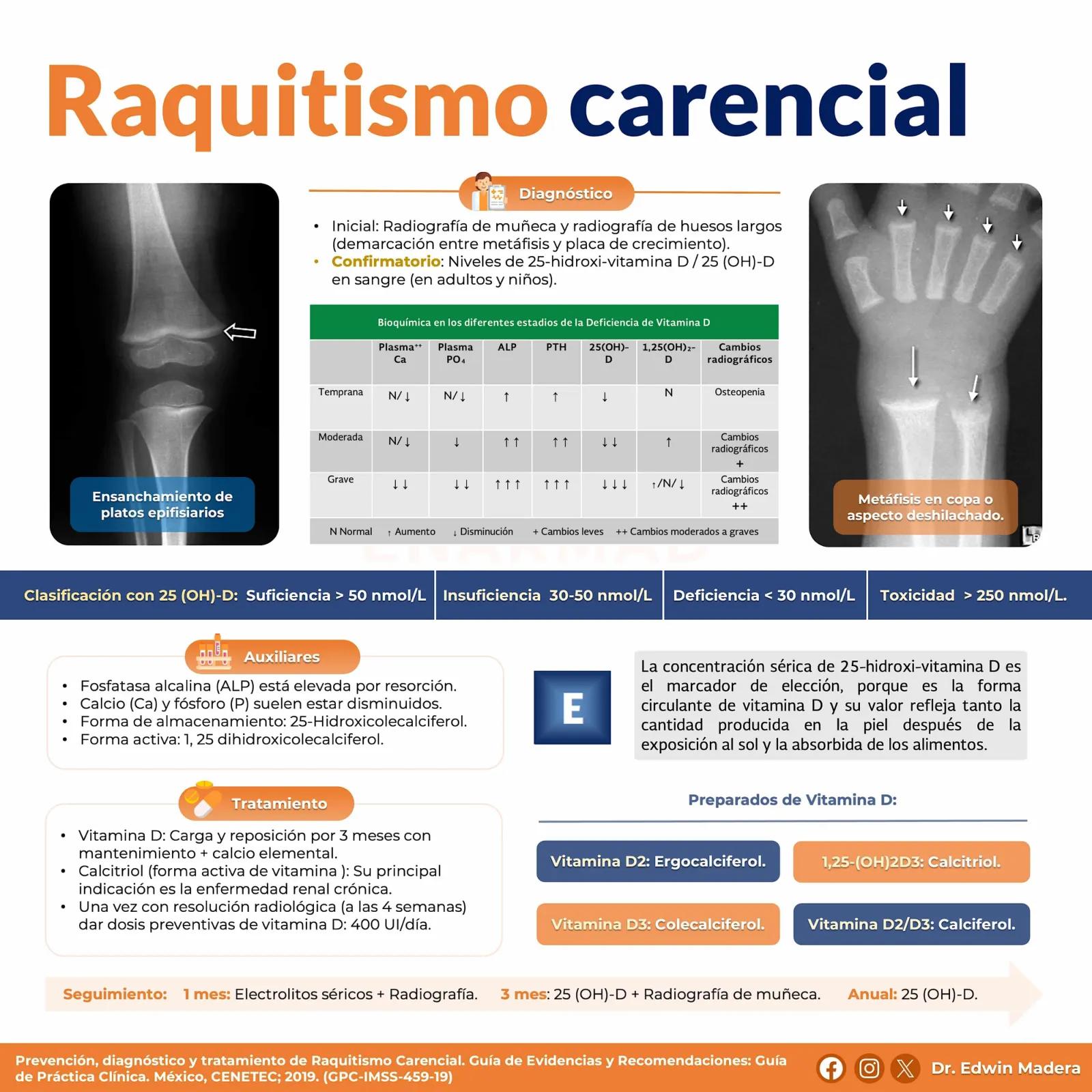 Raquitismo carencial
