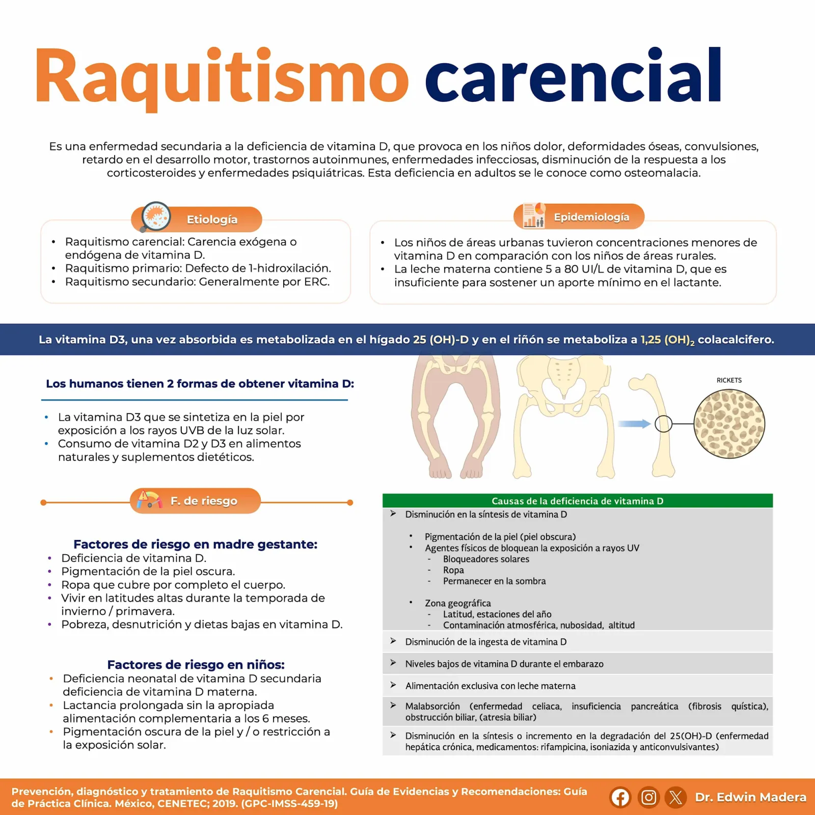 Raquitismo carencial