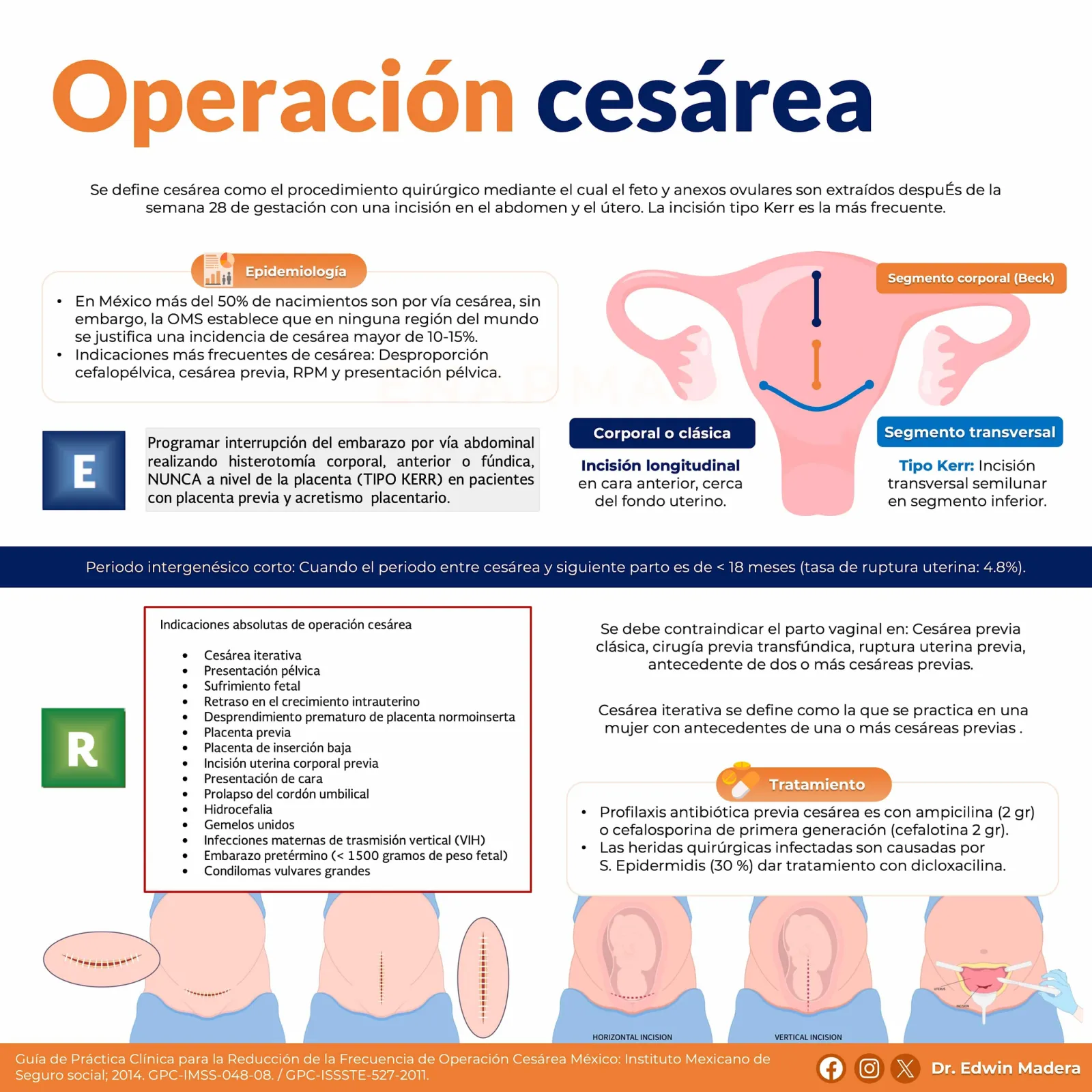 Cesárea