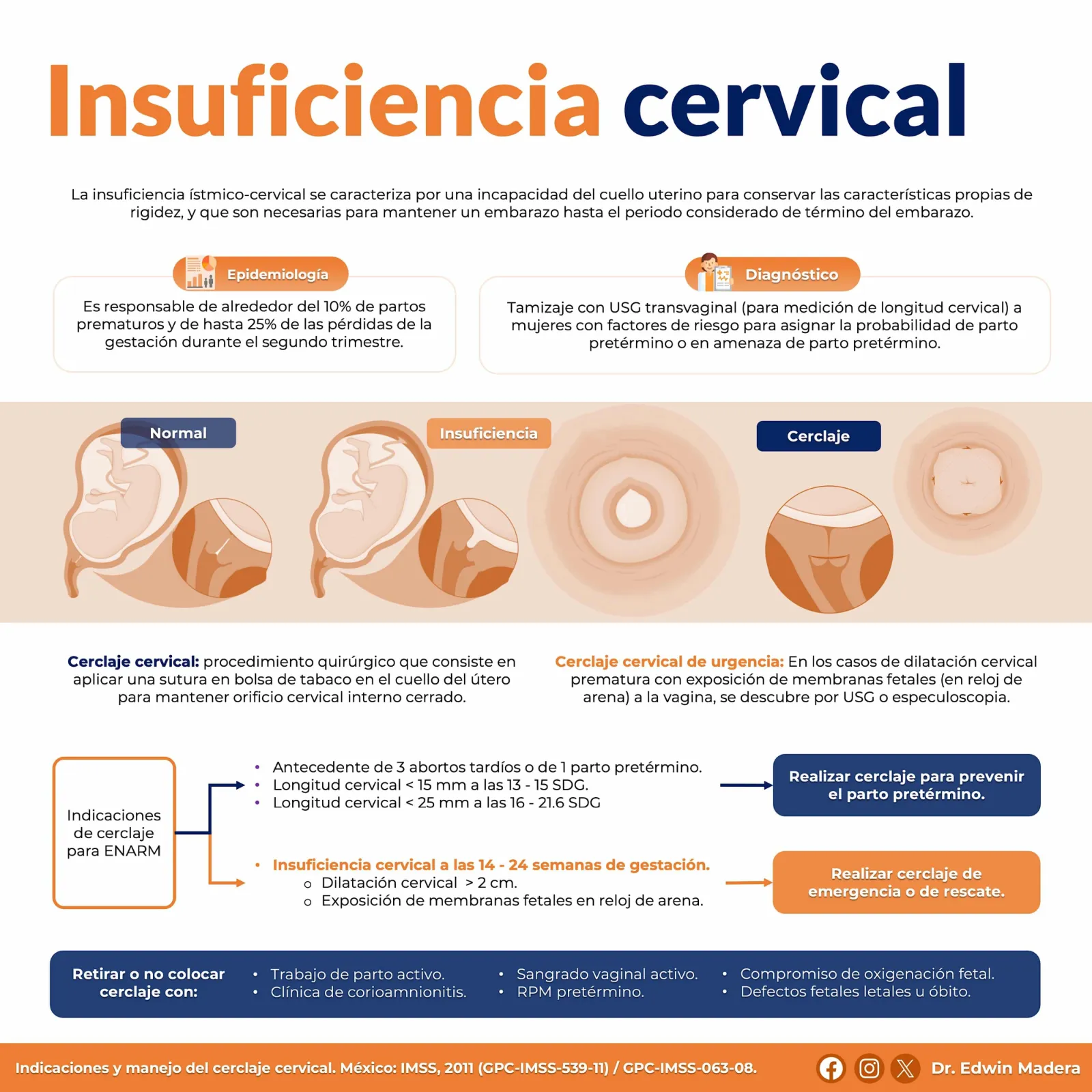 Insuficiencia cervical