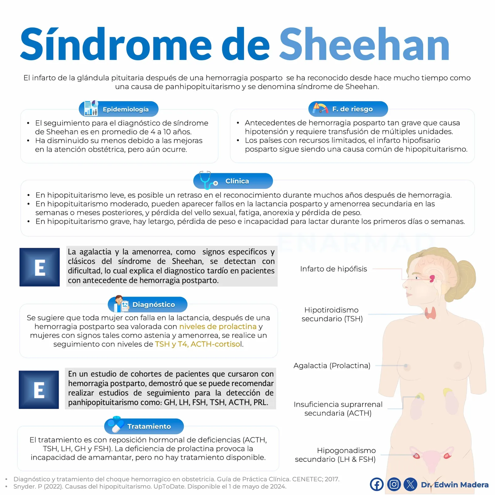 Síndrome de Sheehan