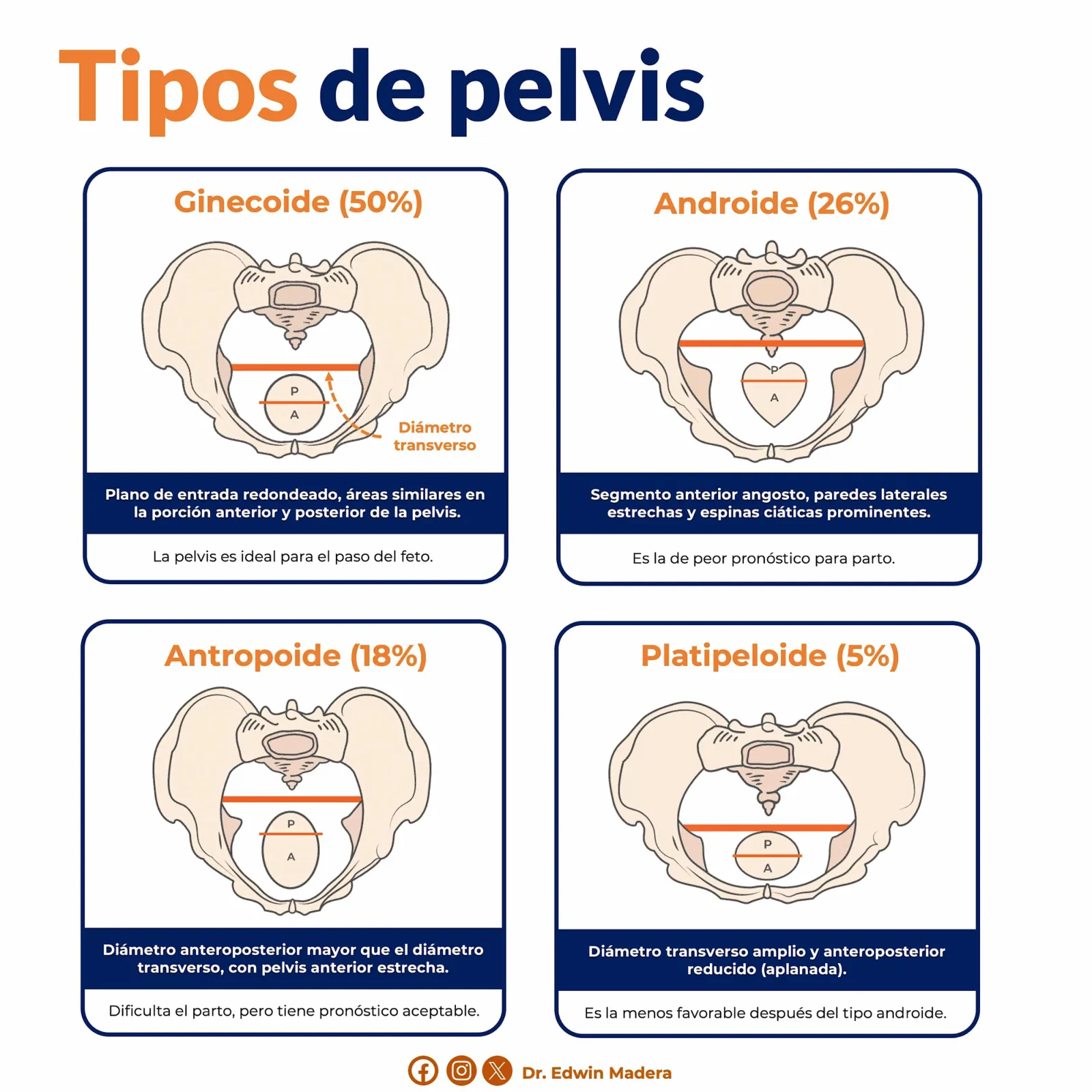 Tipos de pelvis