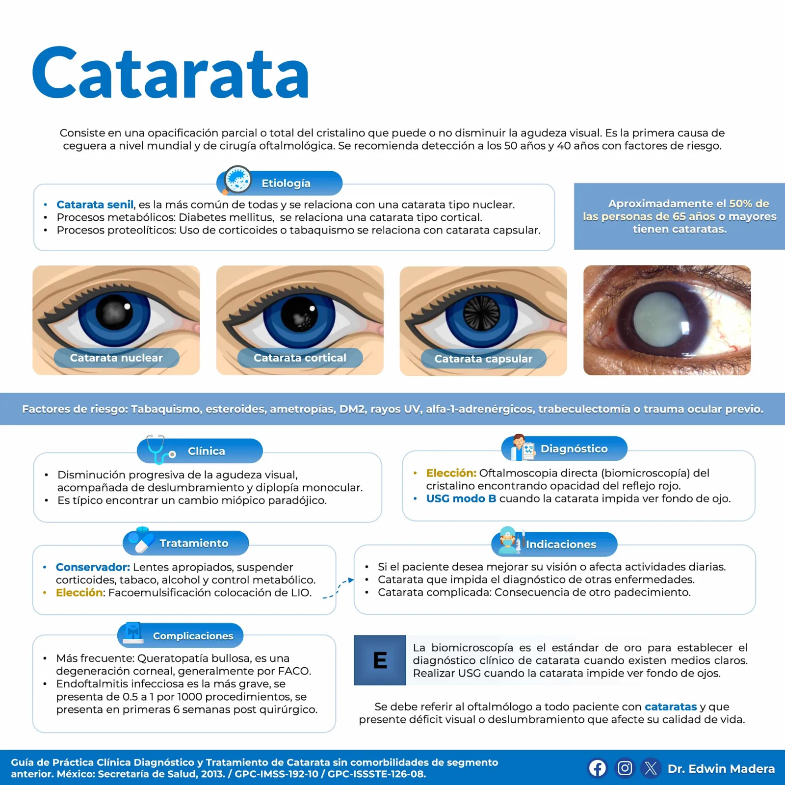 Catarata