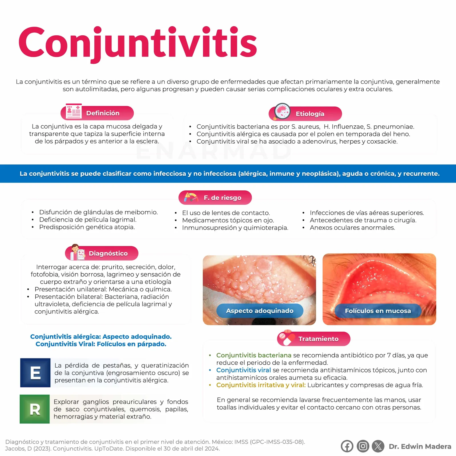 Conjuntivitis