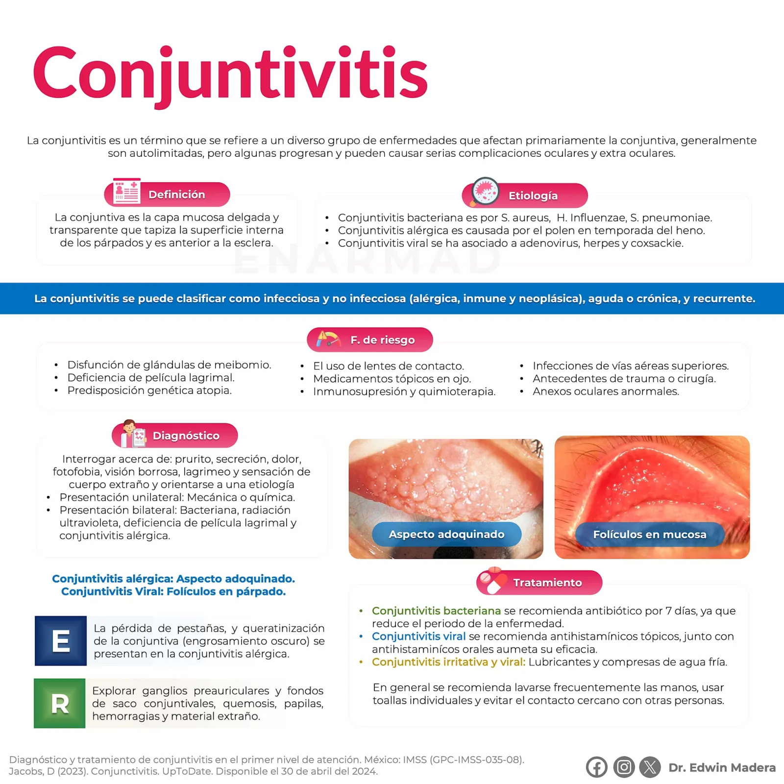 Conjuntivitis alérgica
