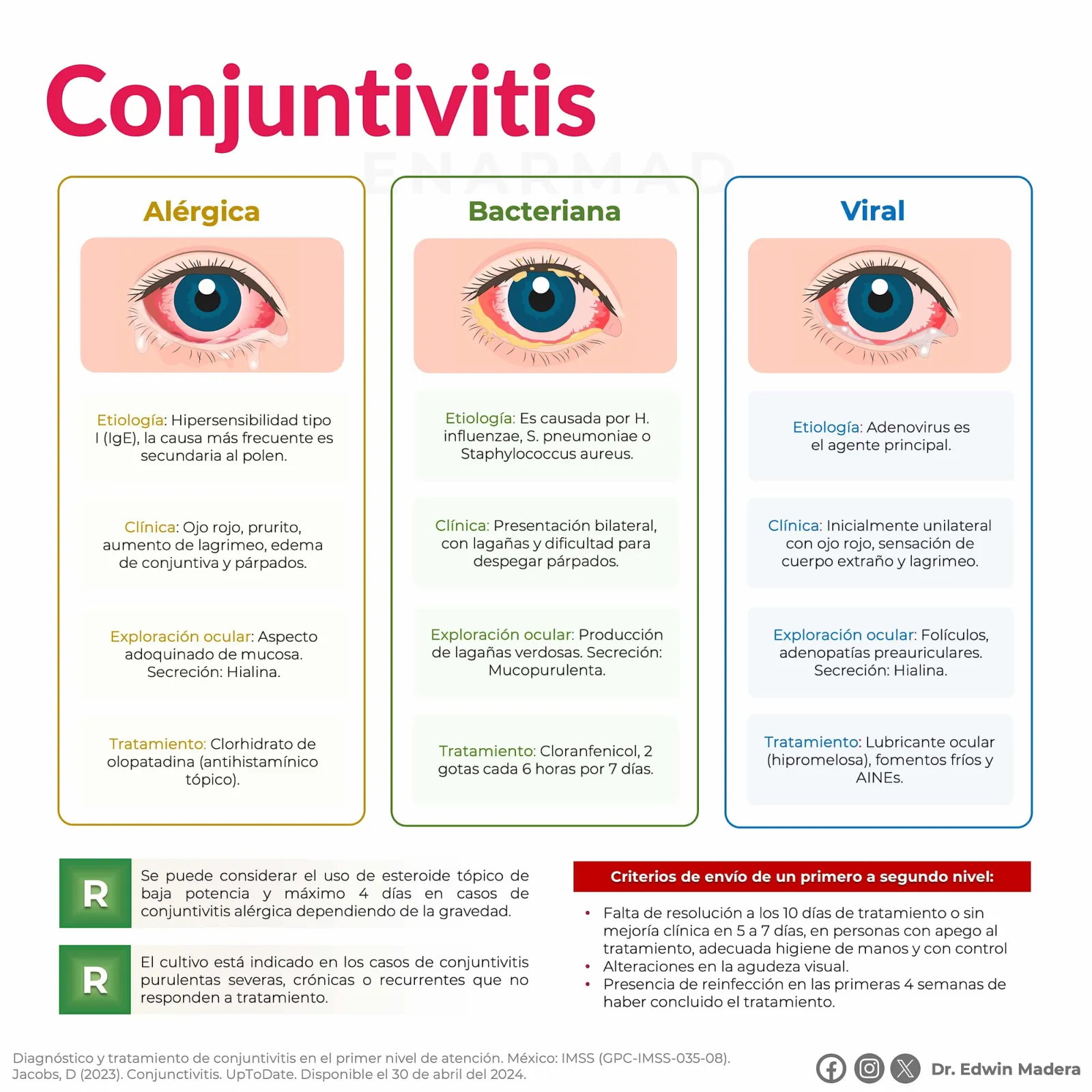 Conjuntivitis alérgica