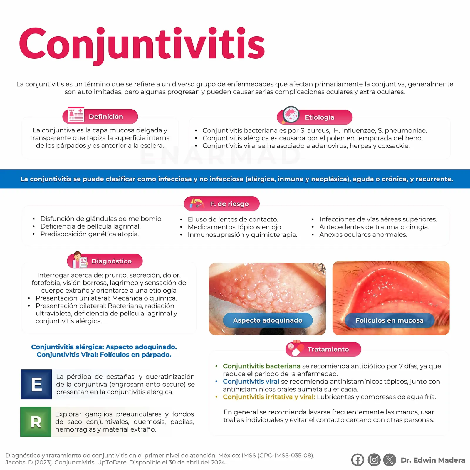 Conjuntivitis bacteriana