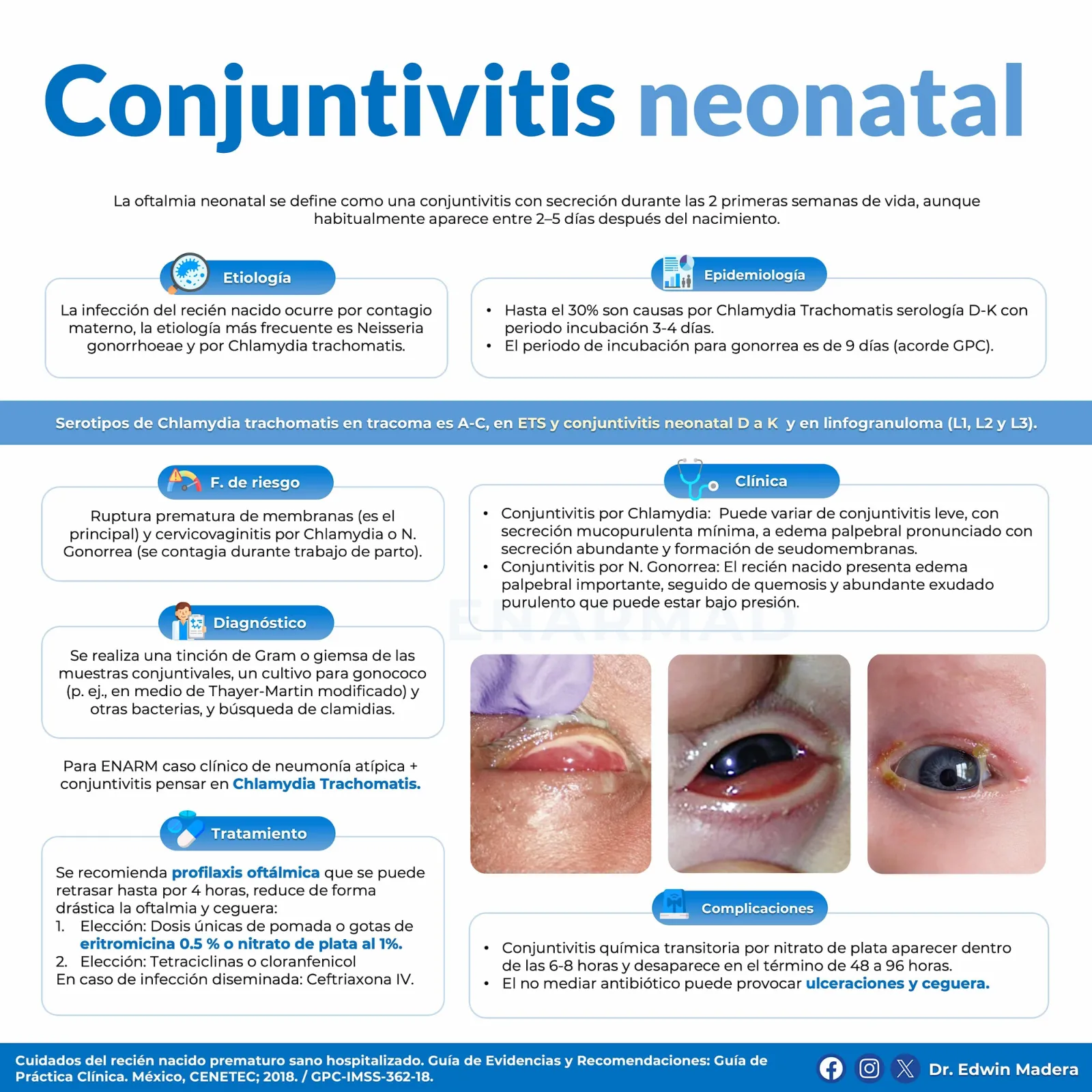 Conjuntivitis neonatal