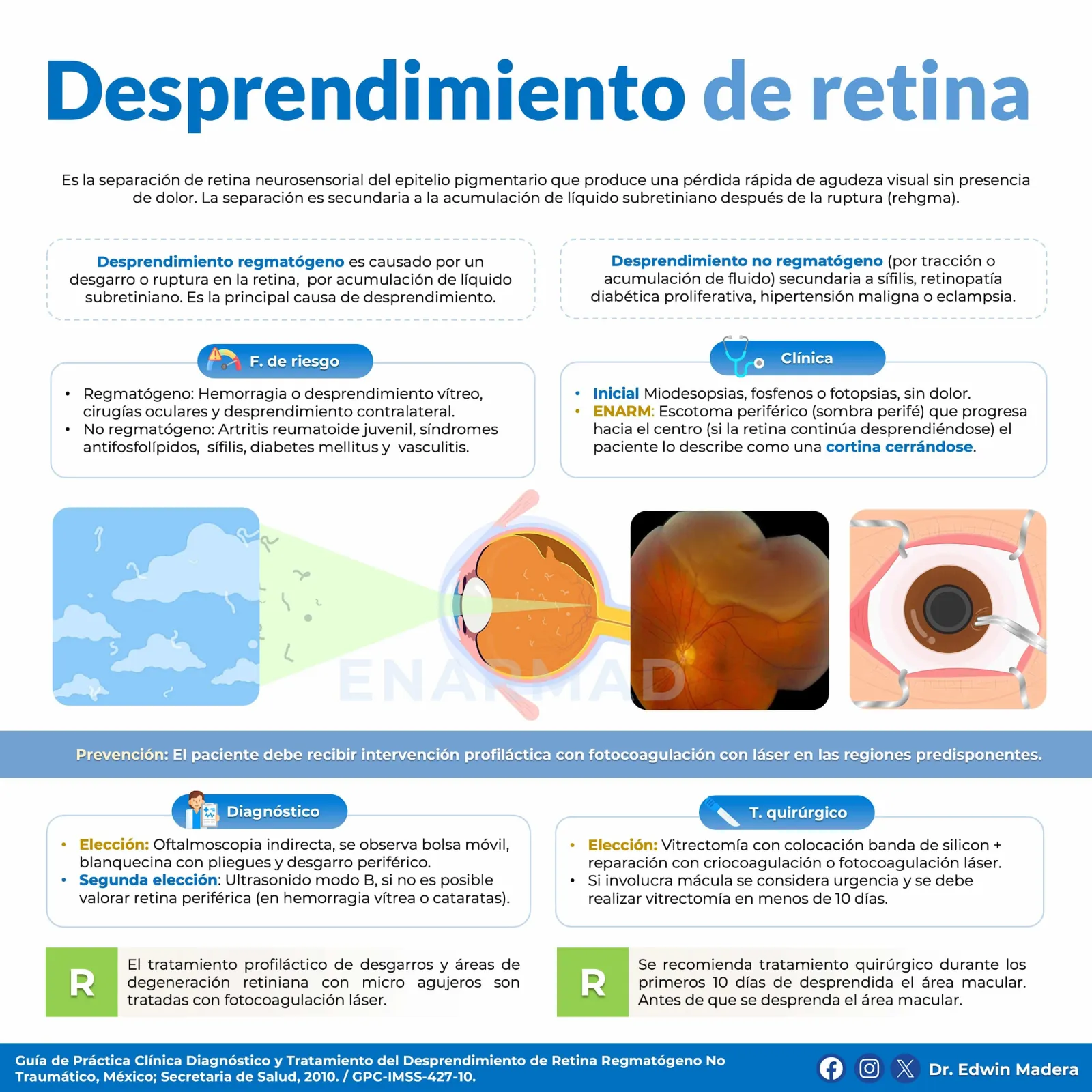 Desprendimiento de retina