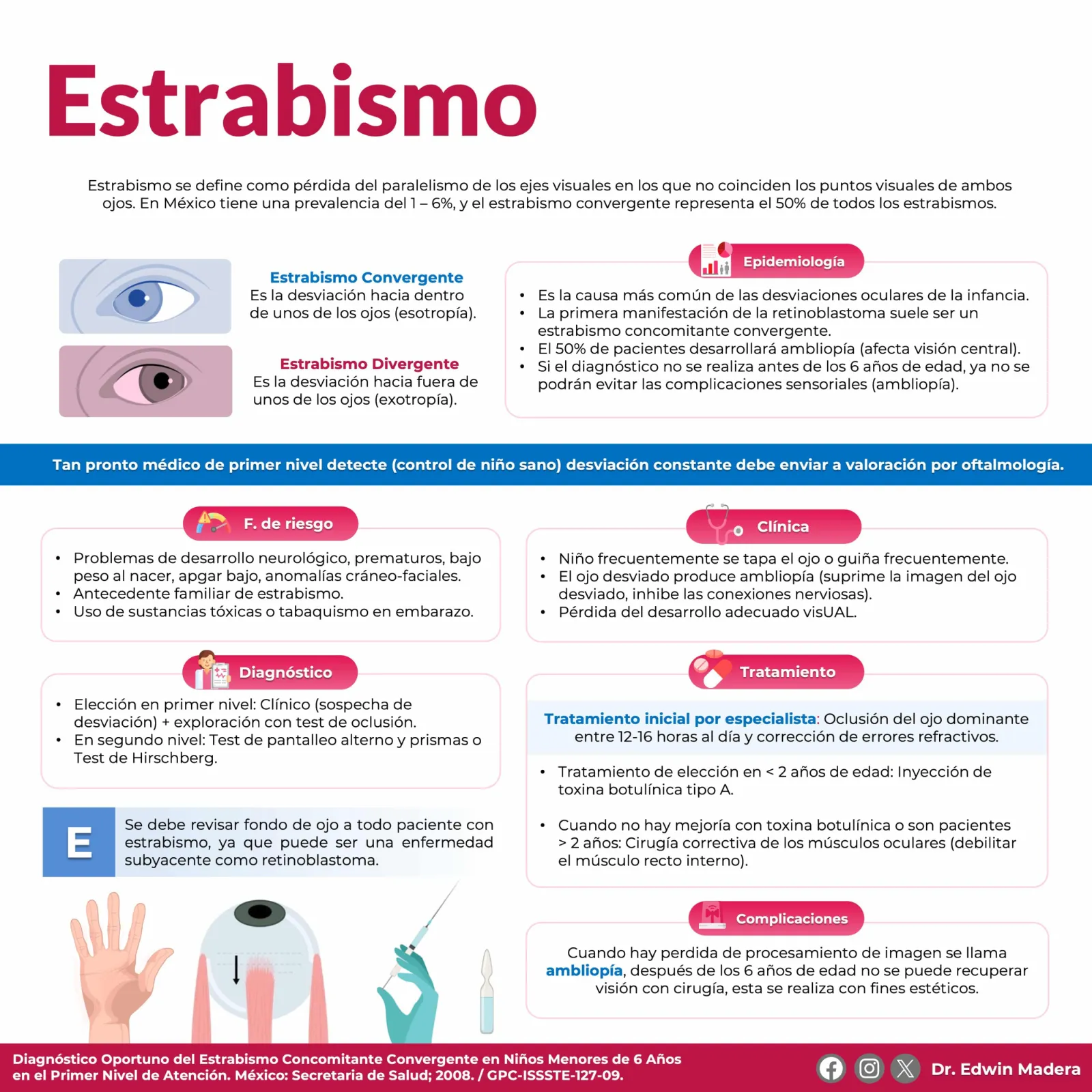 Estrabismo