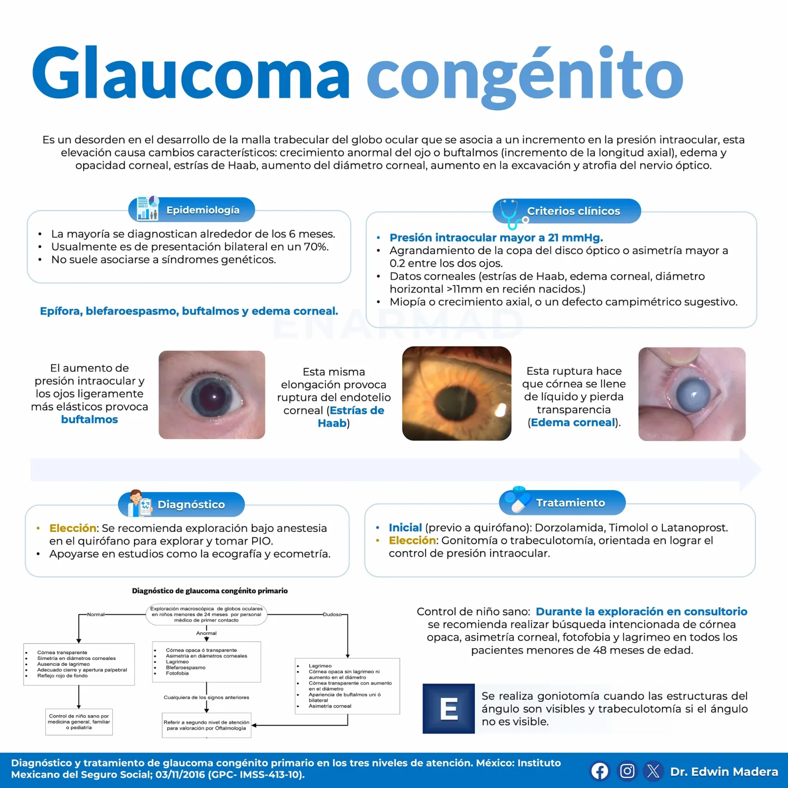Glaucoma congénito