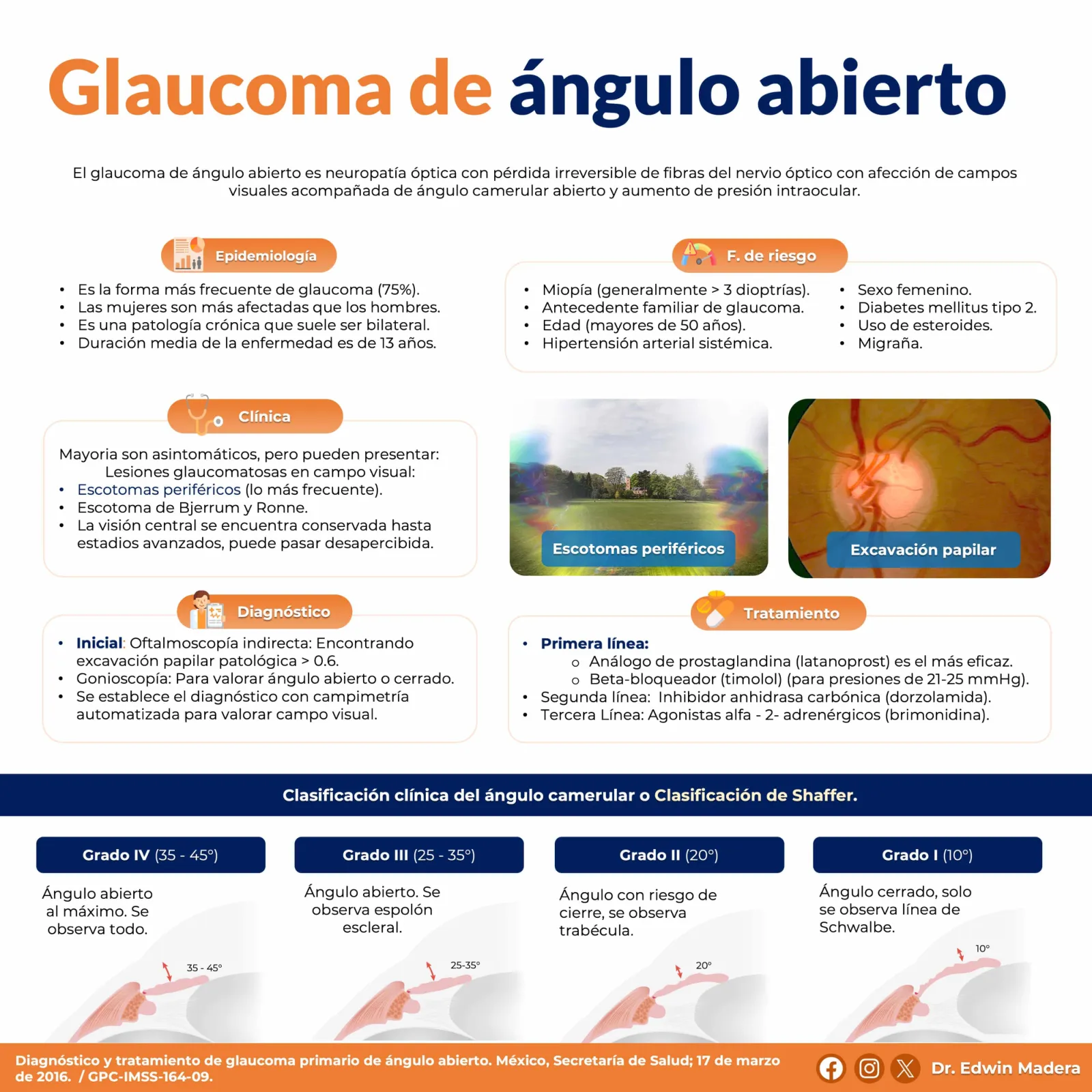 Glaucoma de ángulo abierto