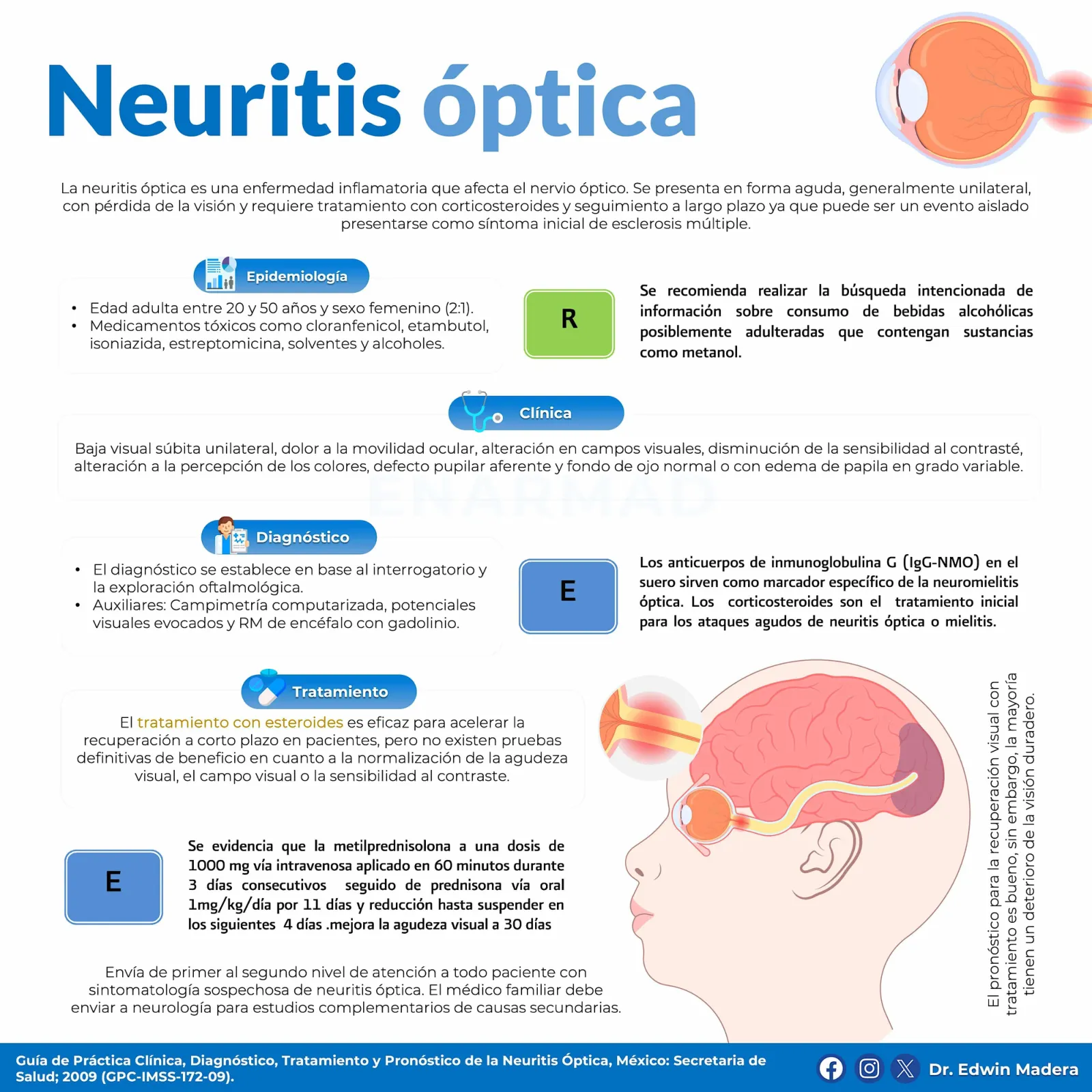 Neuritis óptica