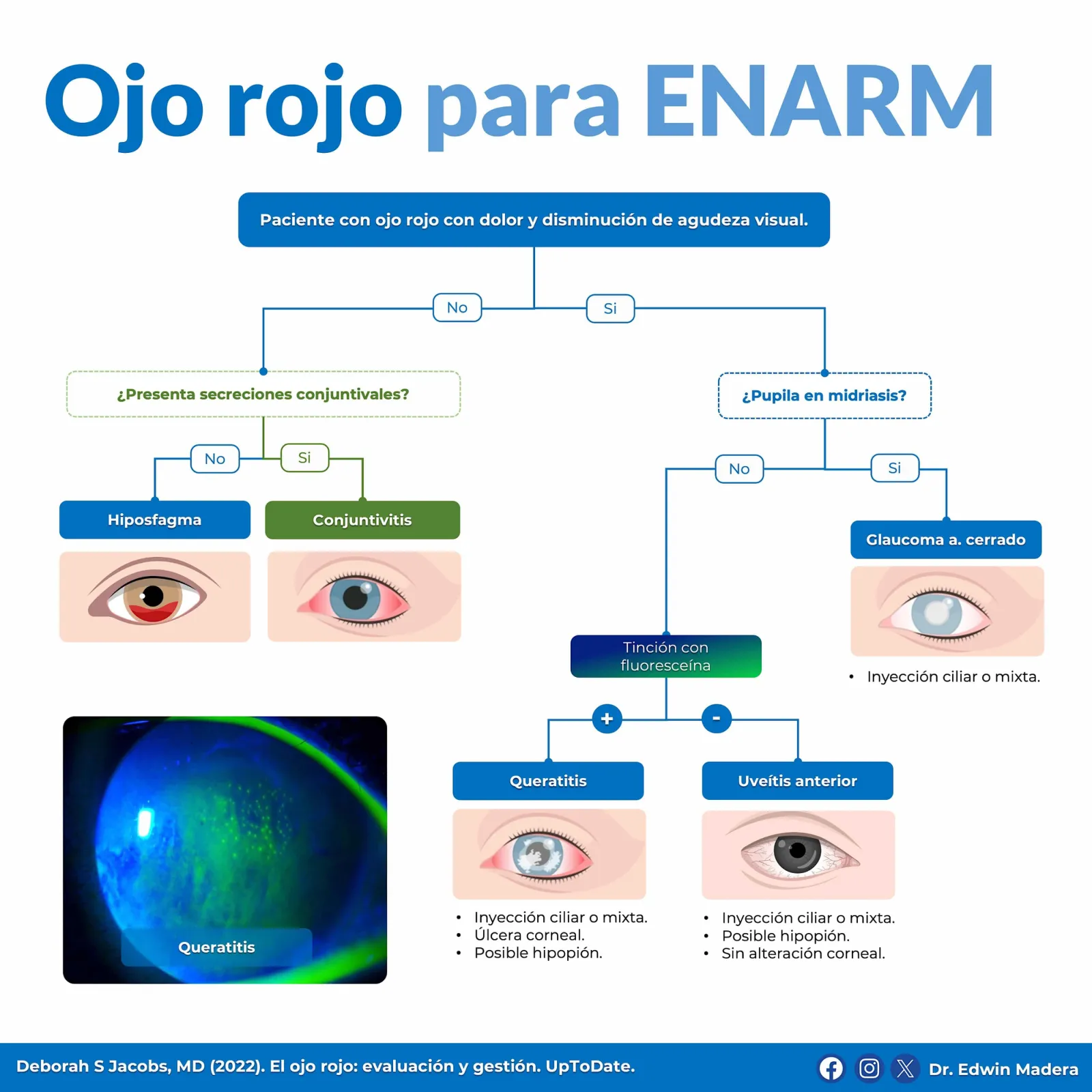 Ojo rojo