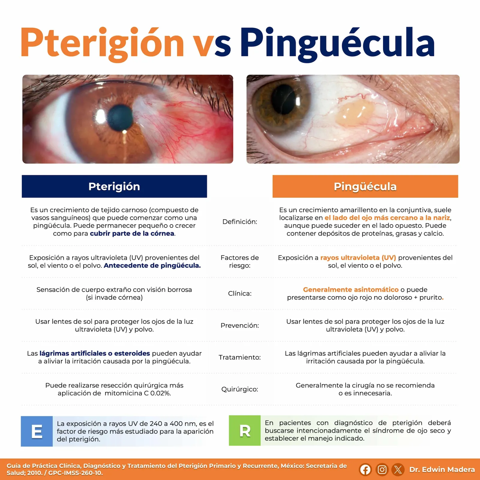 Pterigión