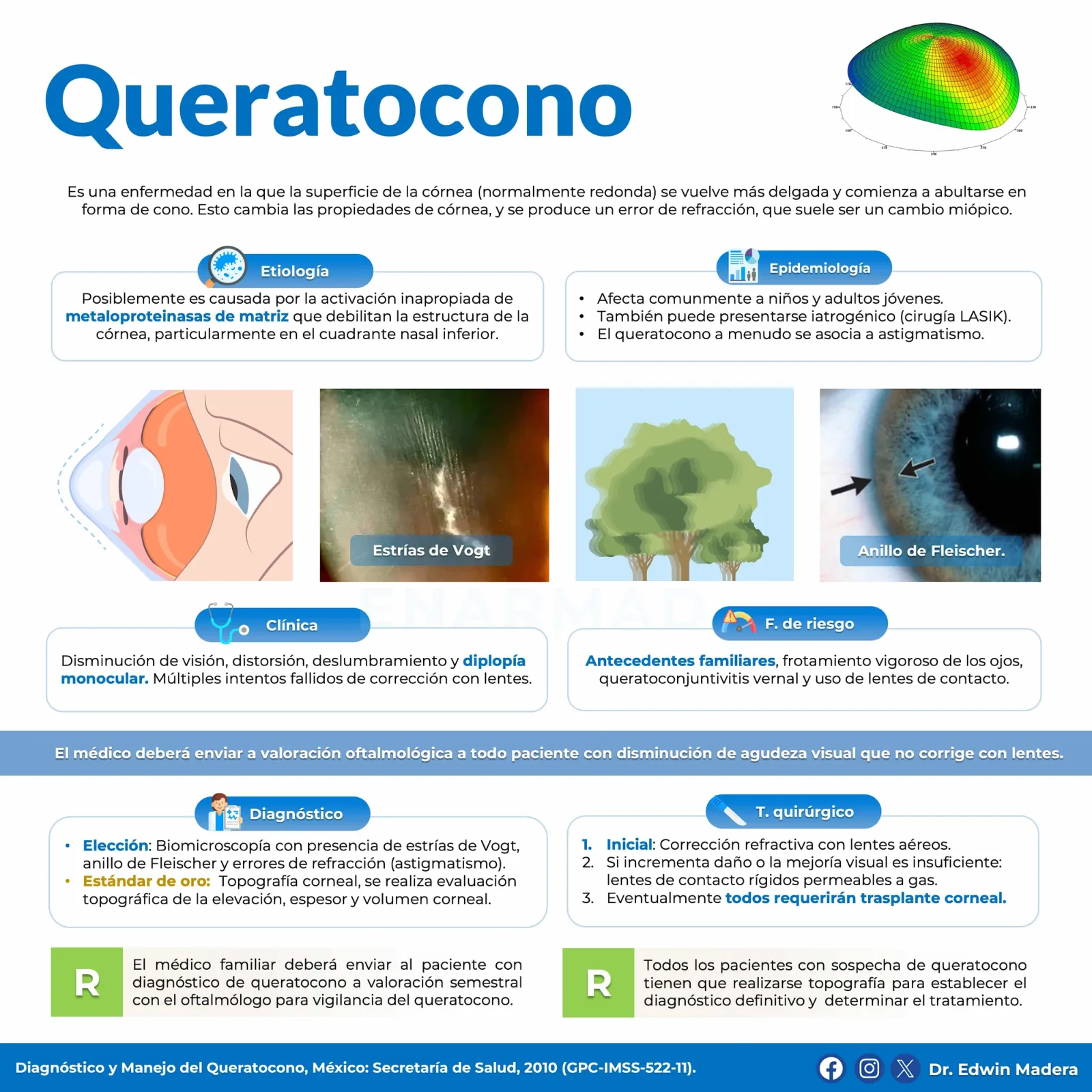 Queratocono