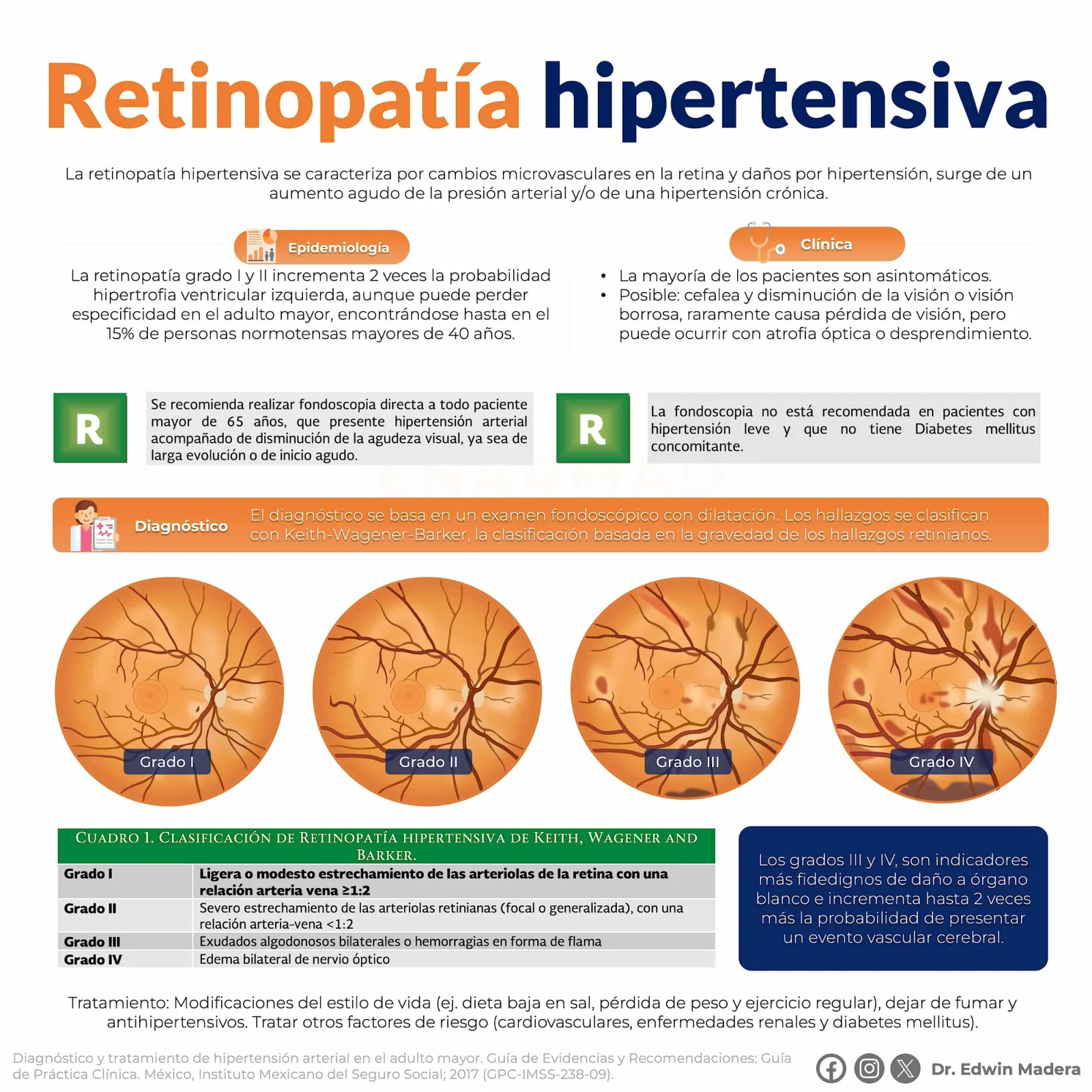 Retinopatía hipertensiva