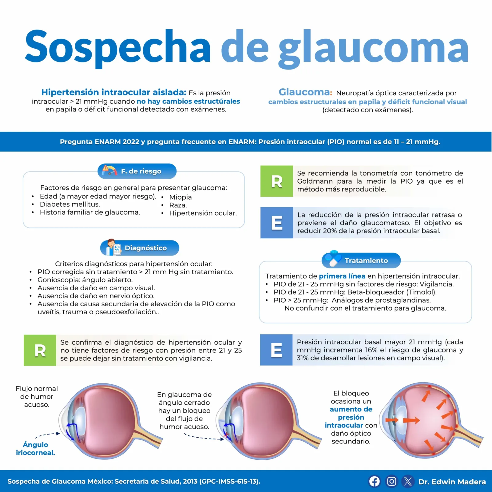 Sospecha de glaucoma