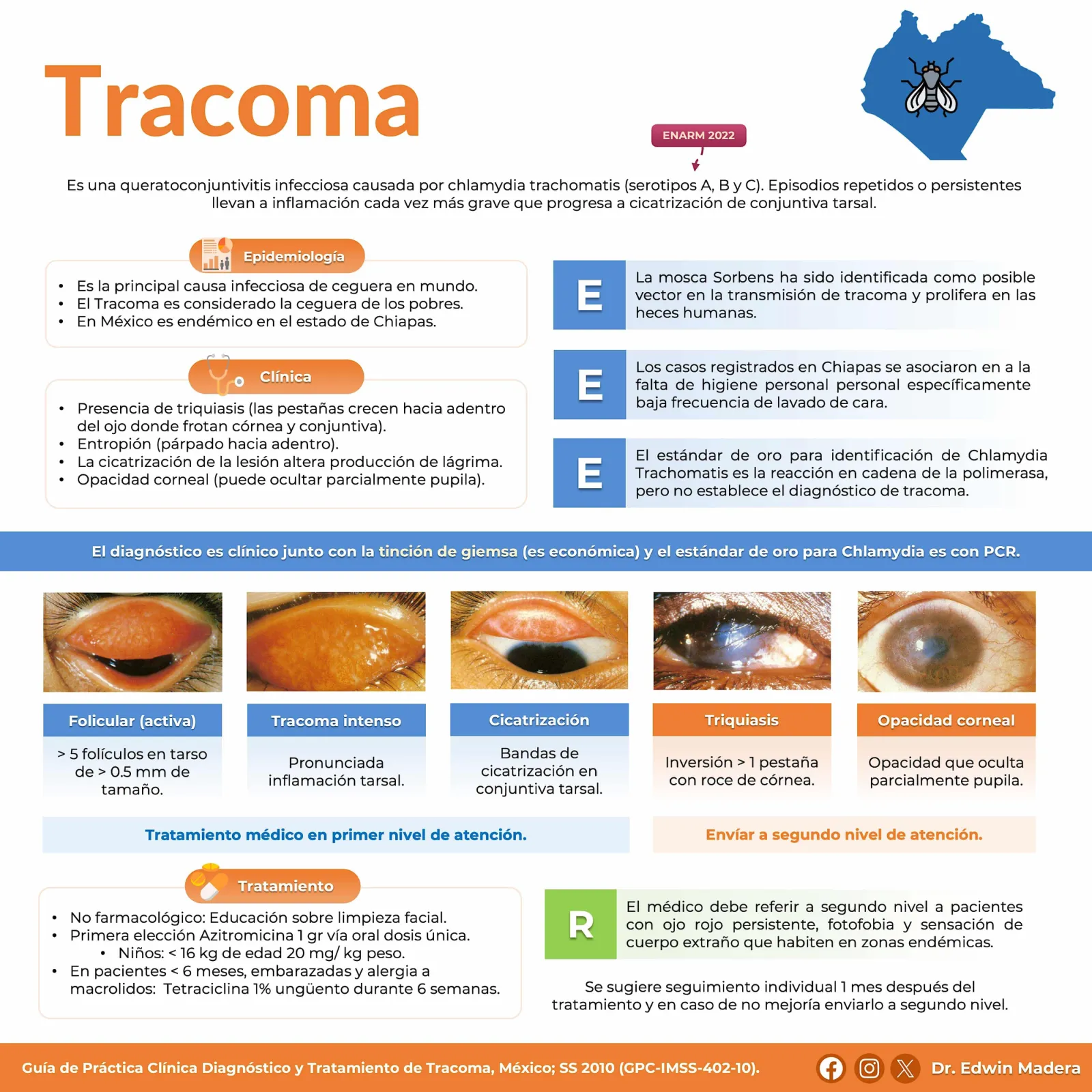 Tracoma