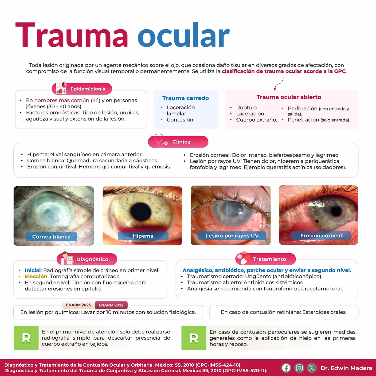 Trauma ocular