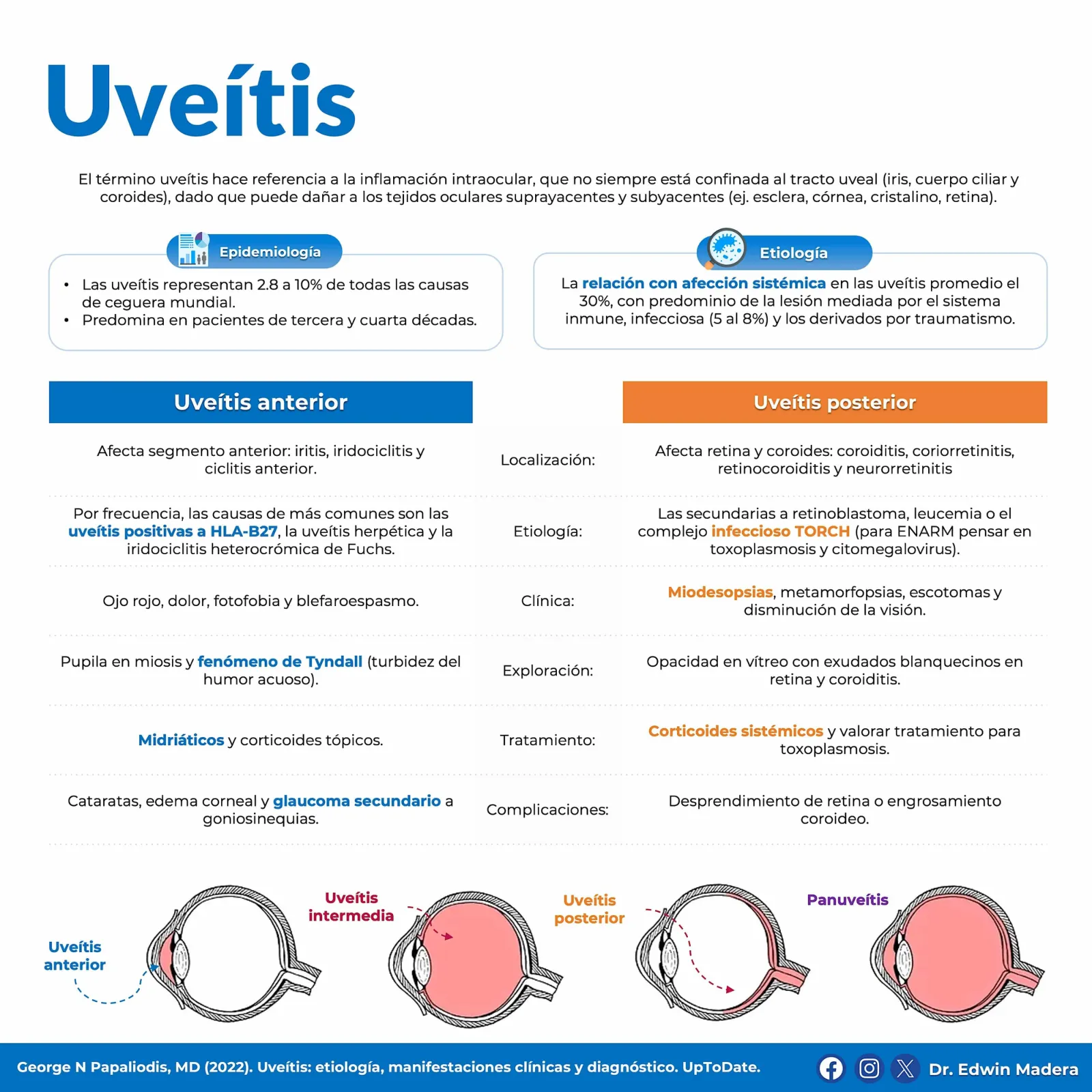 Uveítis