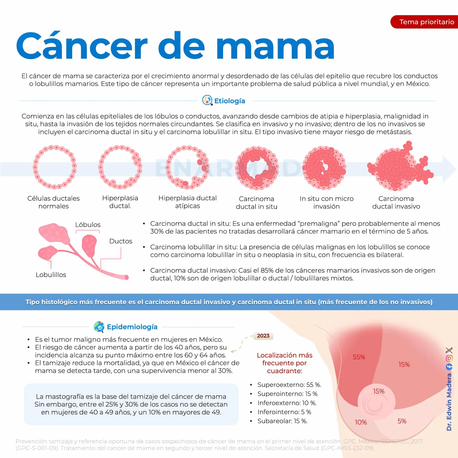 Cáncer de mama