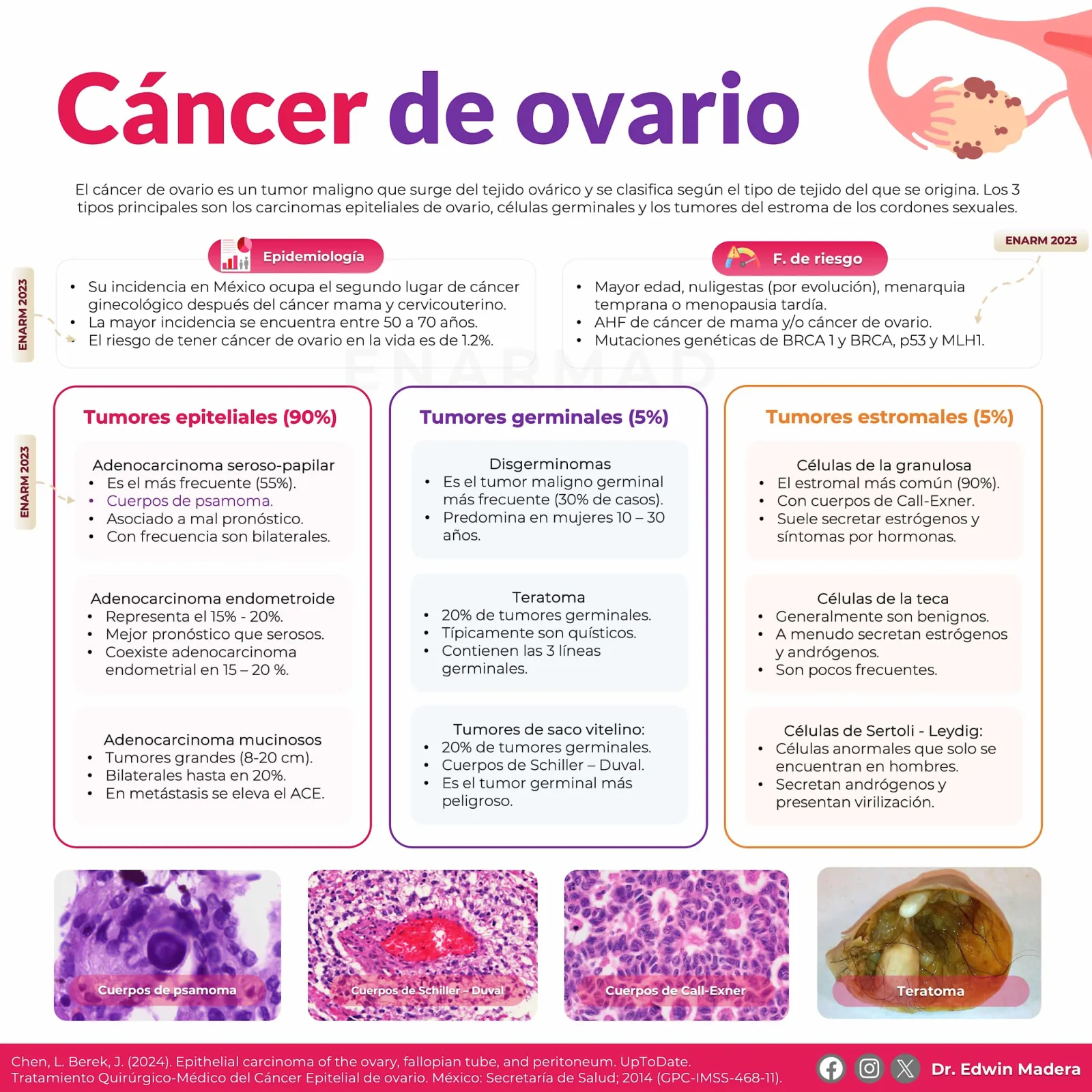 Cáncer de ovario