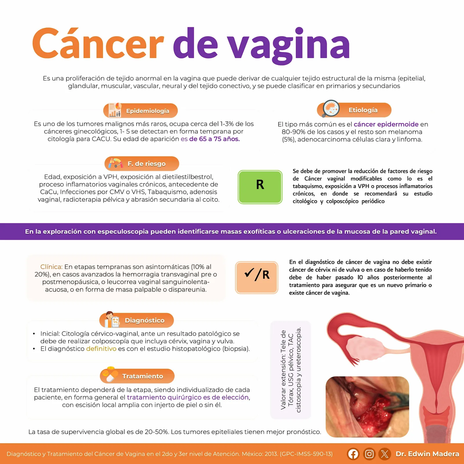 Cáncer de vagina