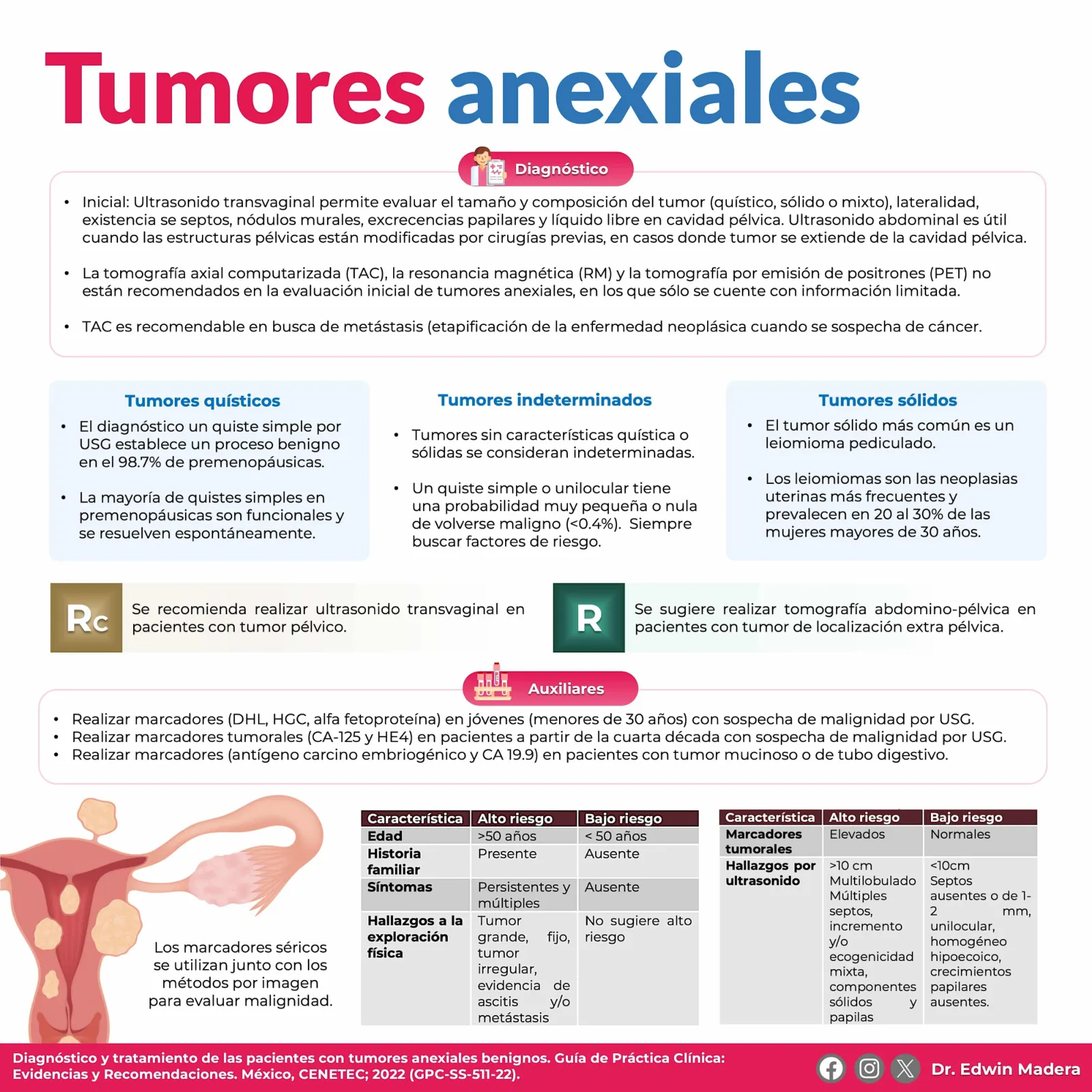 Tumores anexiales