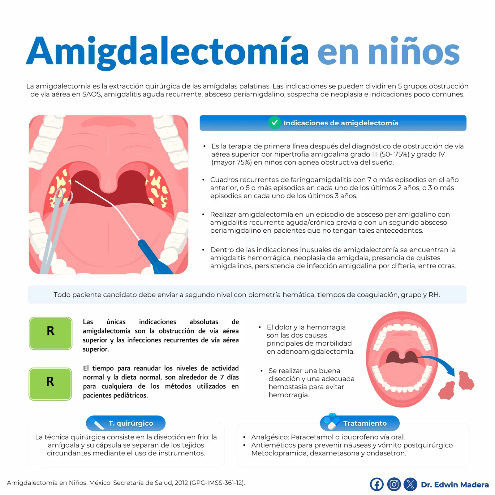 Amigdalectomía en niños