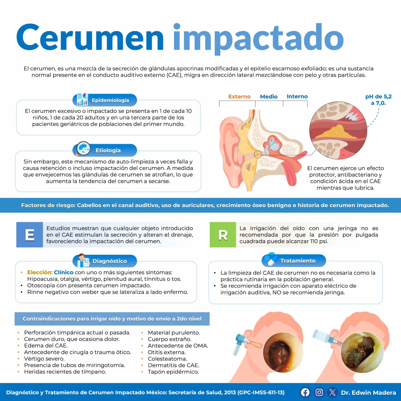 Cerumen impactado