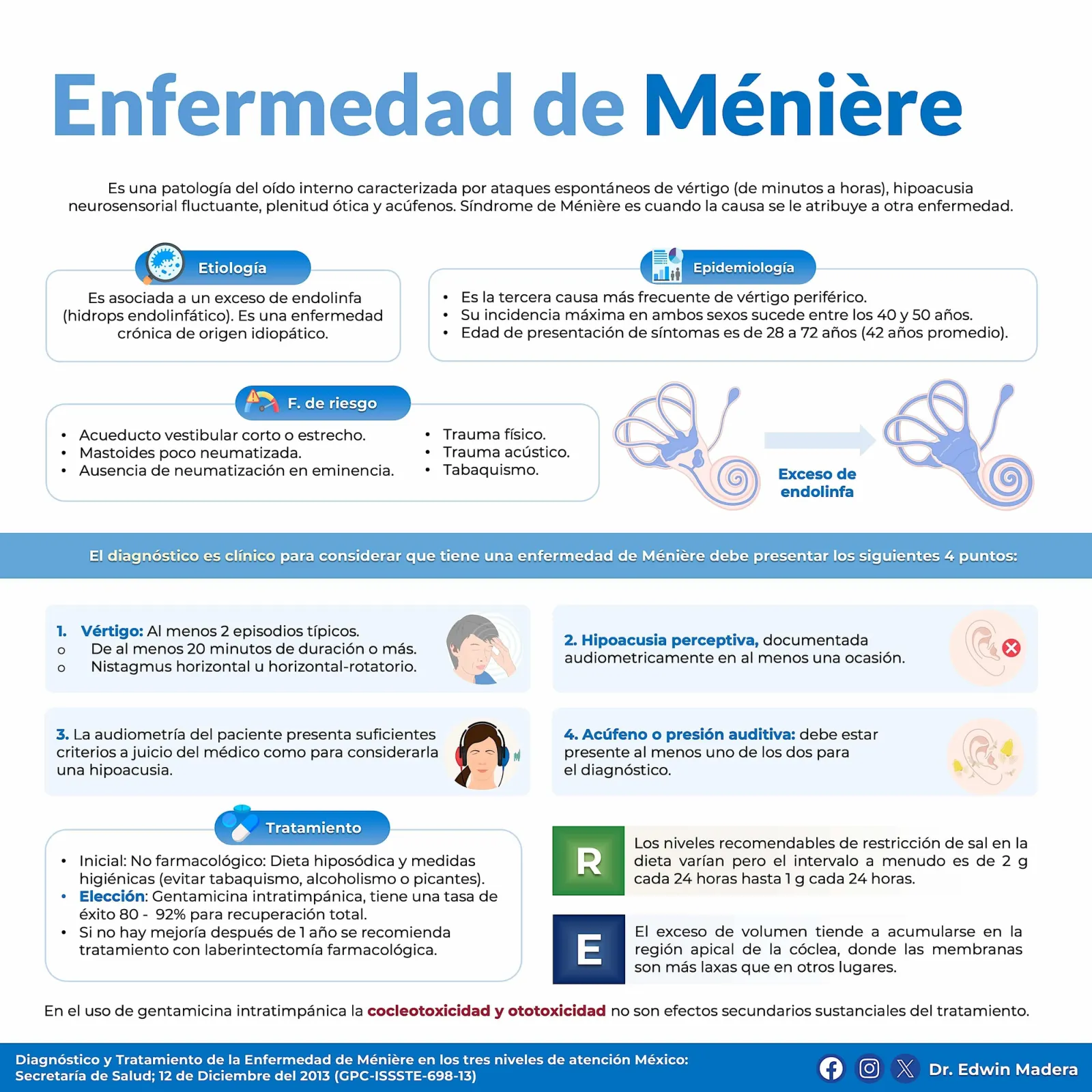Enfermedad de Meniére