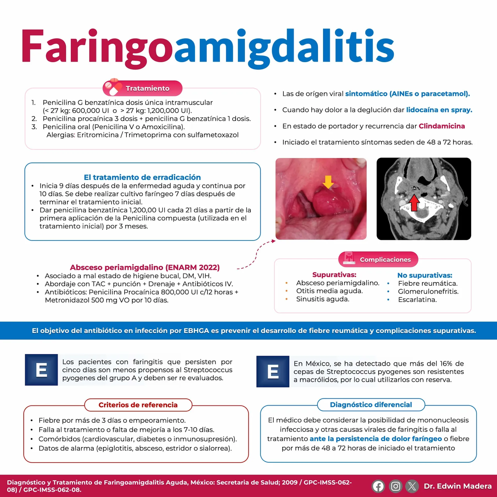 Faringoamigdalitis