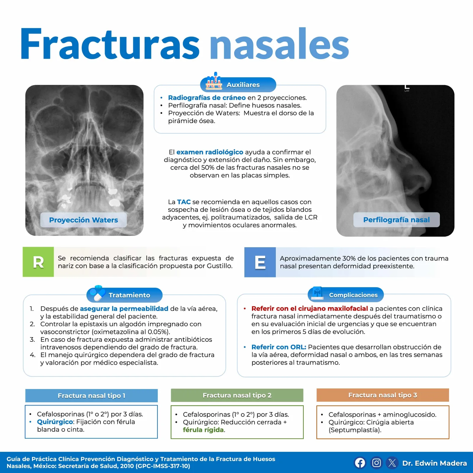 Fracturas nasales
