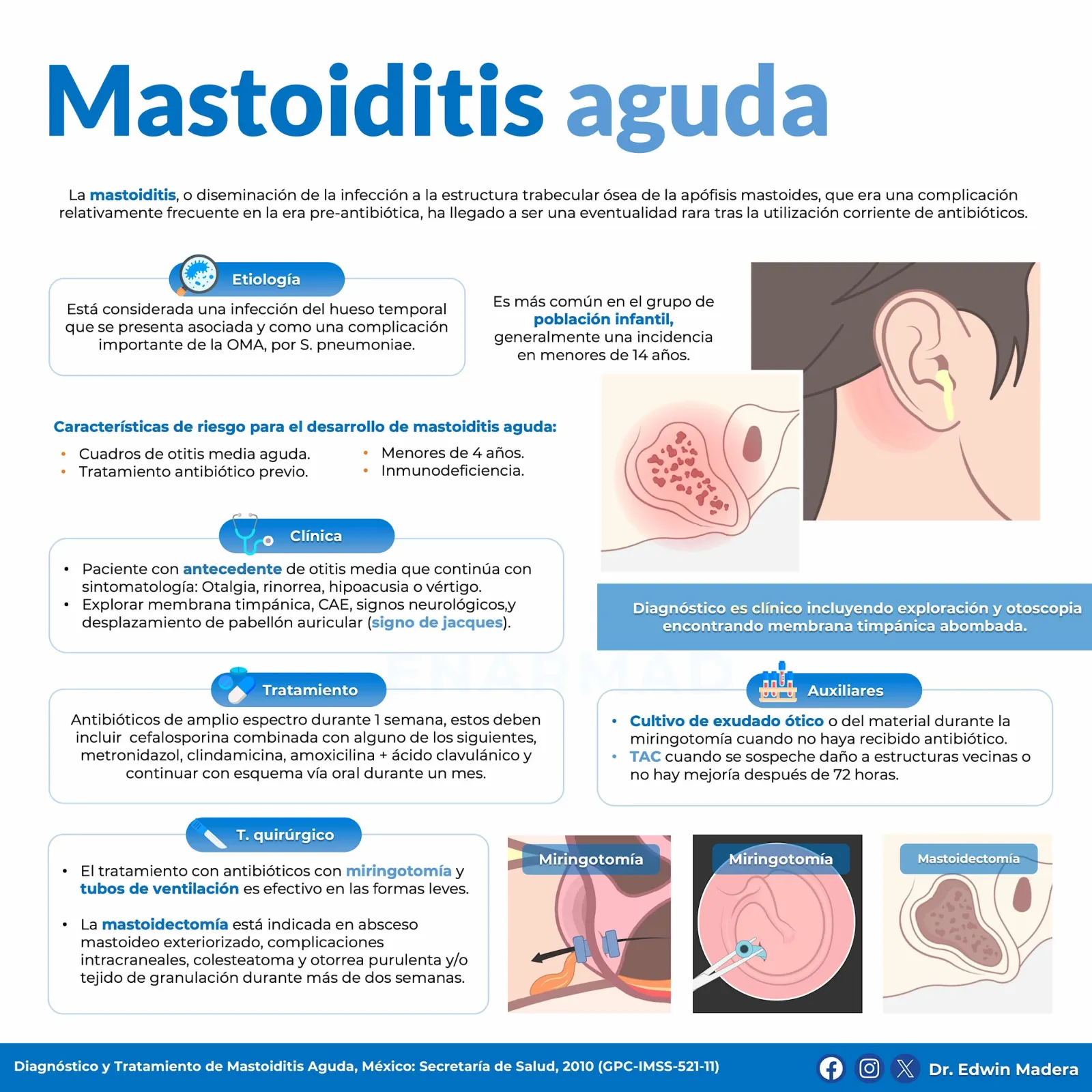 Mastoiditis aguda