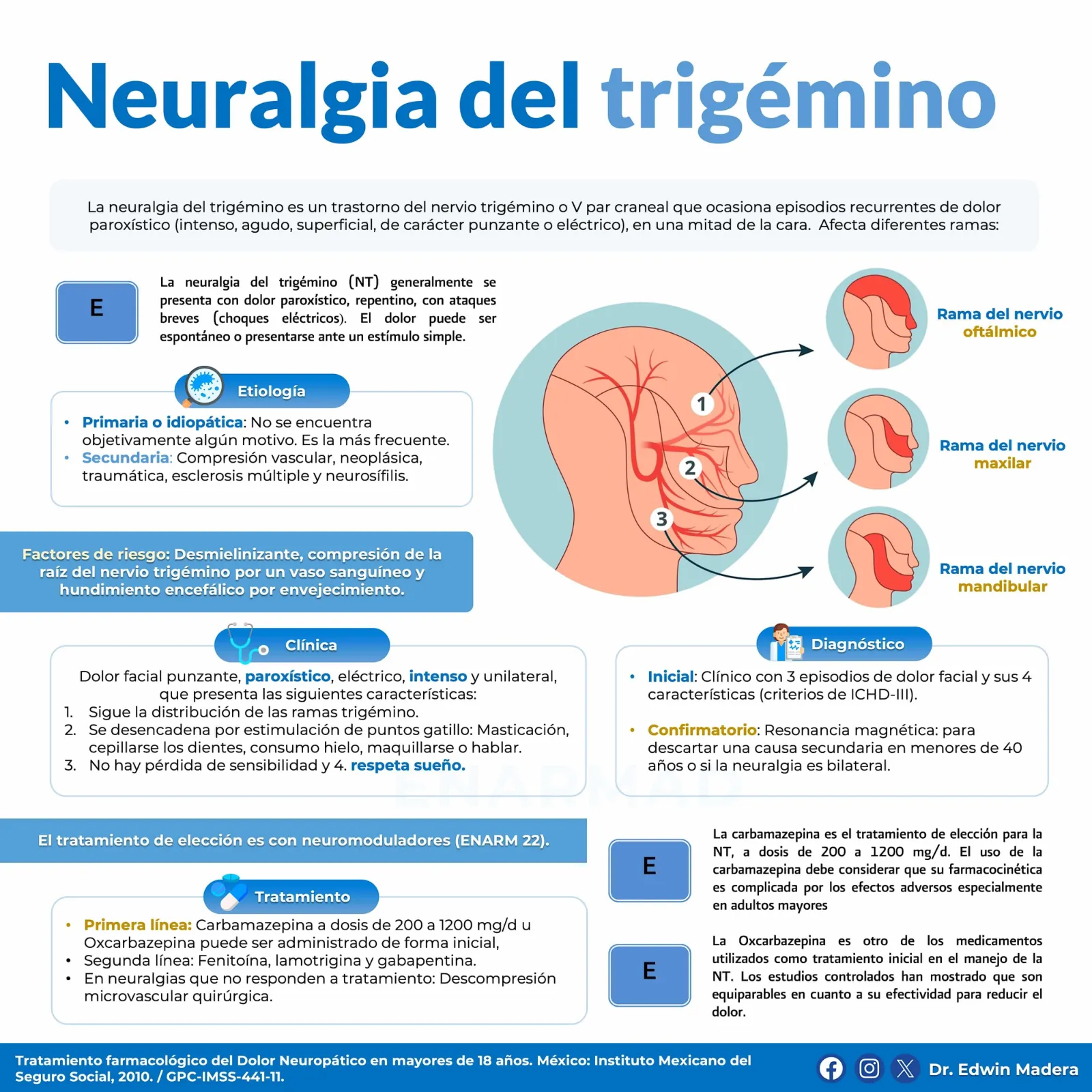 Neuralgia de trigémino