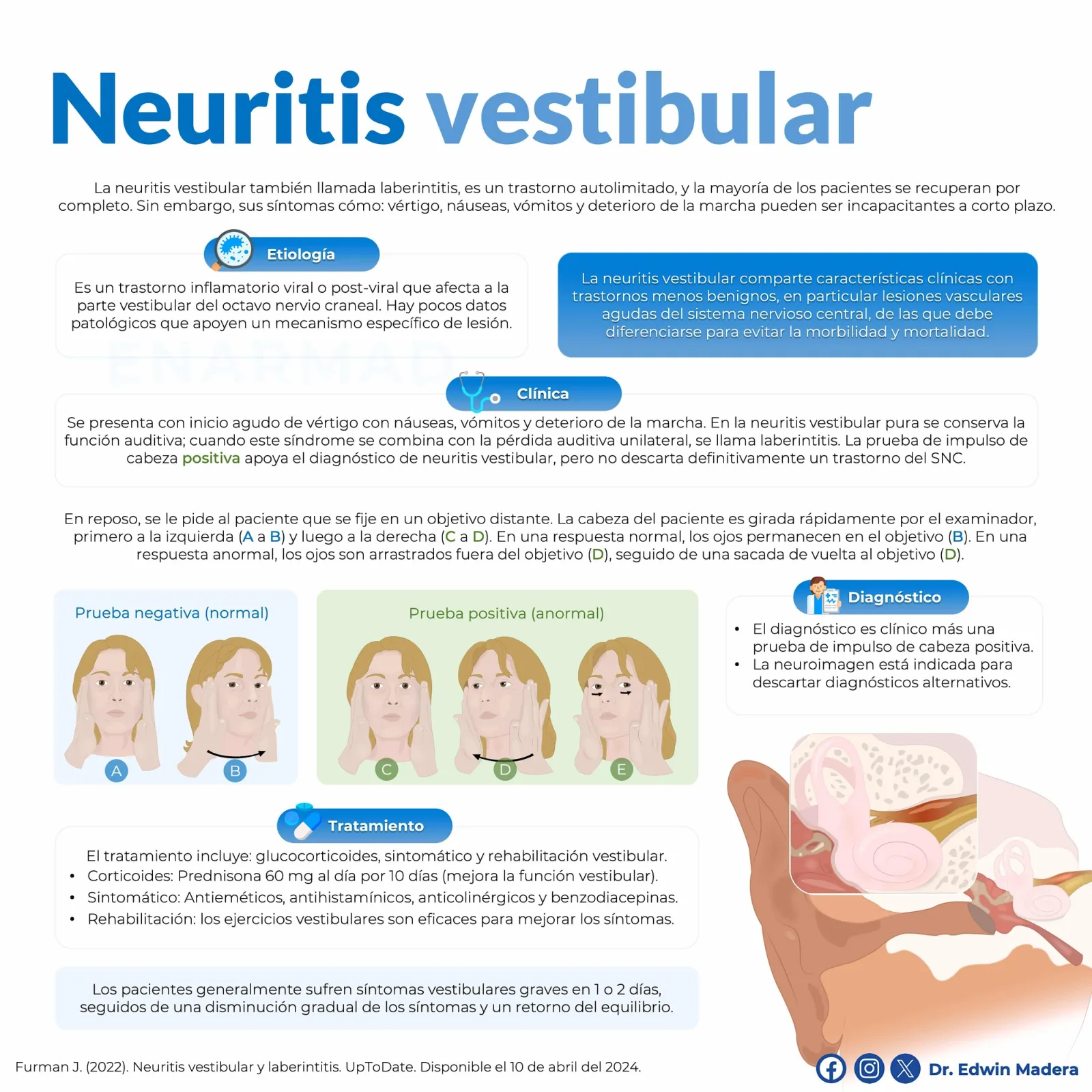 Neuritis vestibular