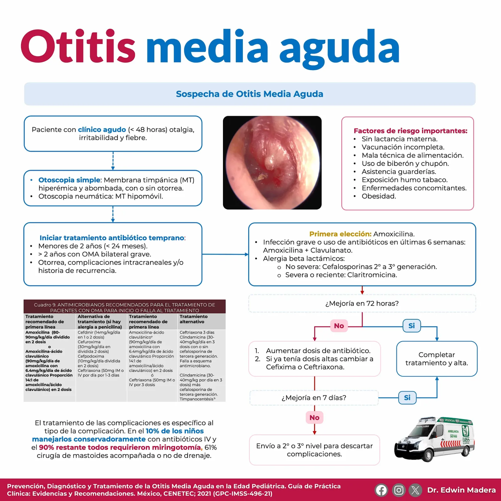 Otitis media aguda