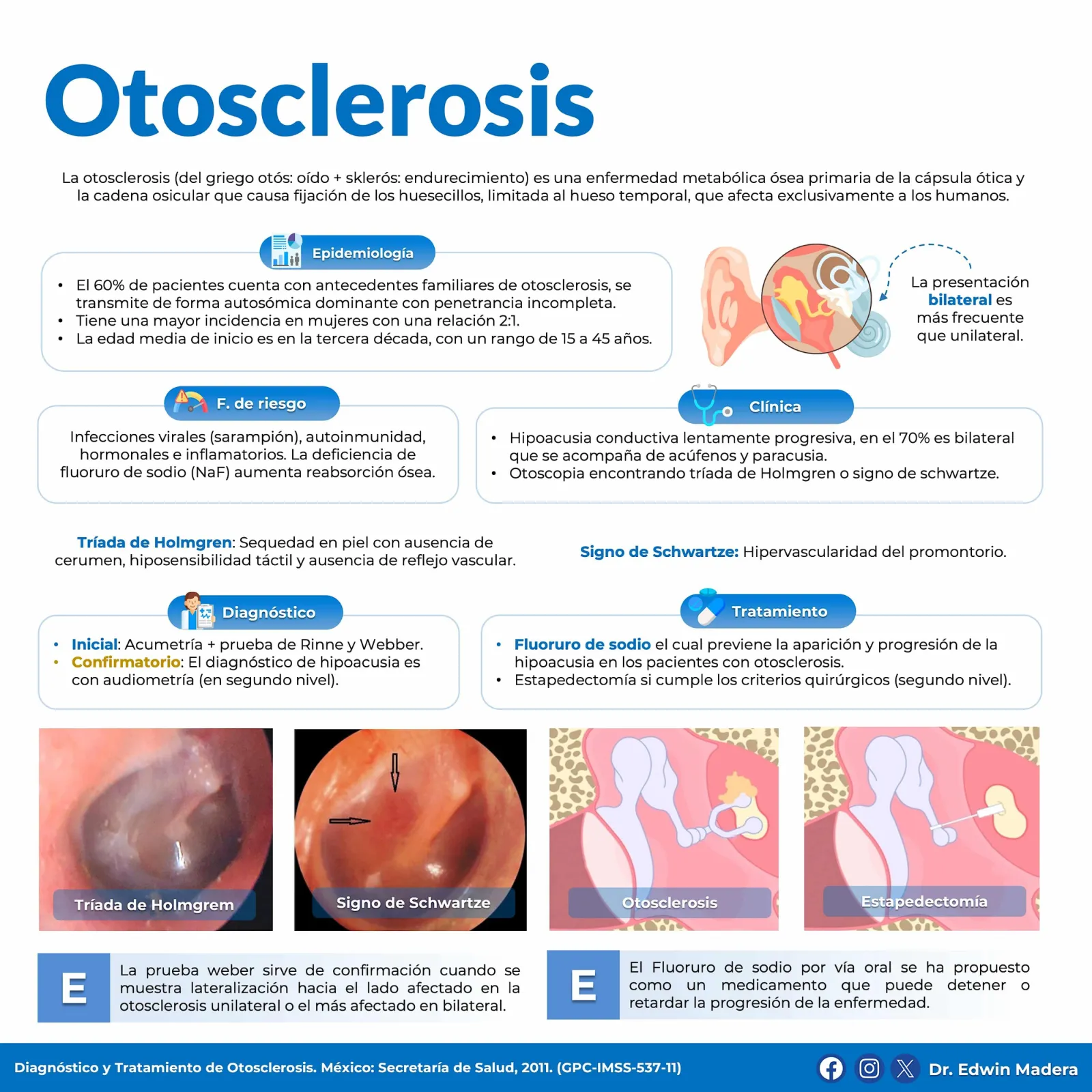 Otosclerosis
