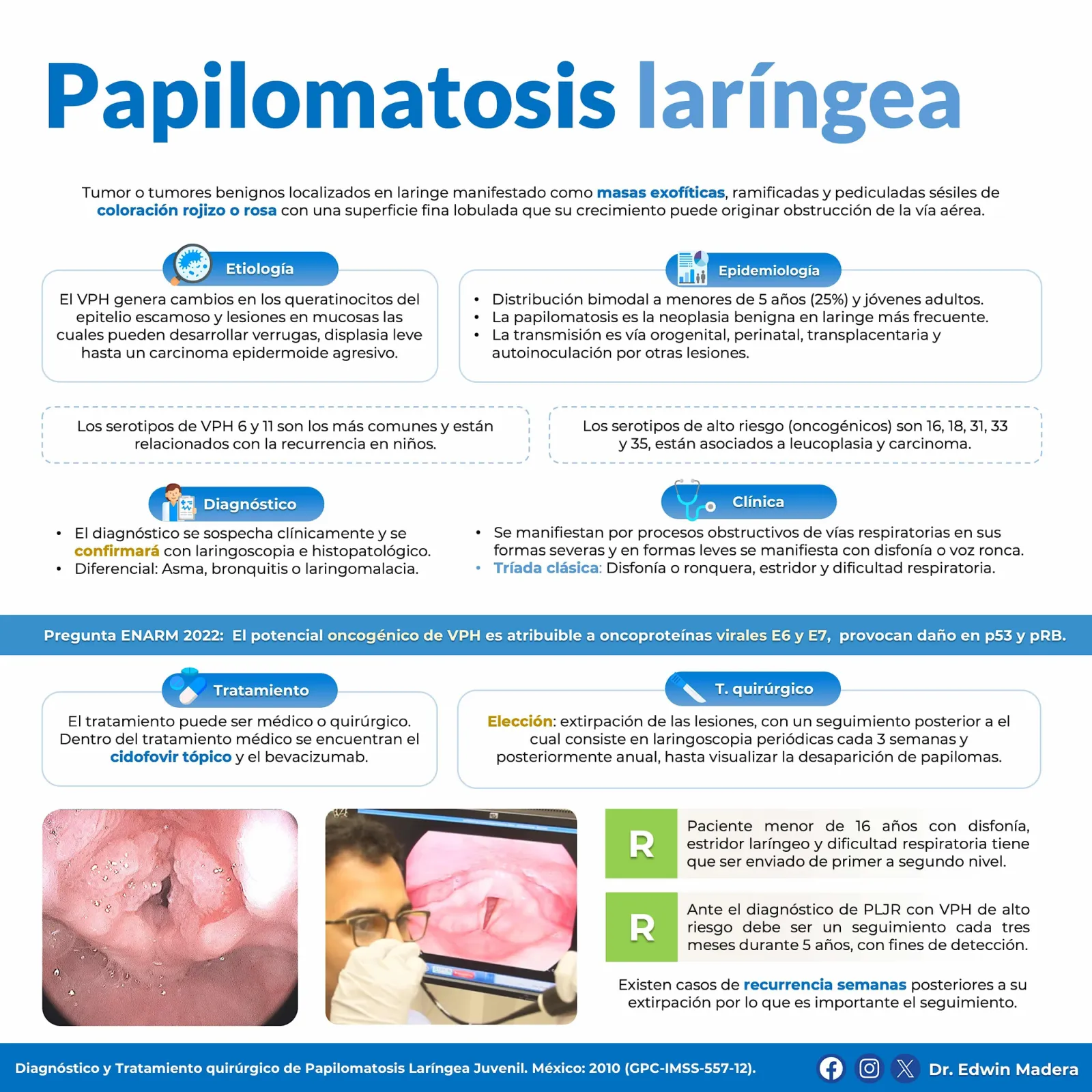 Papilomatosis laíngea juvenil